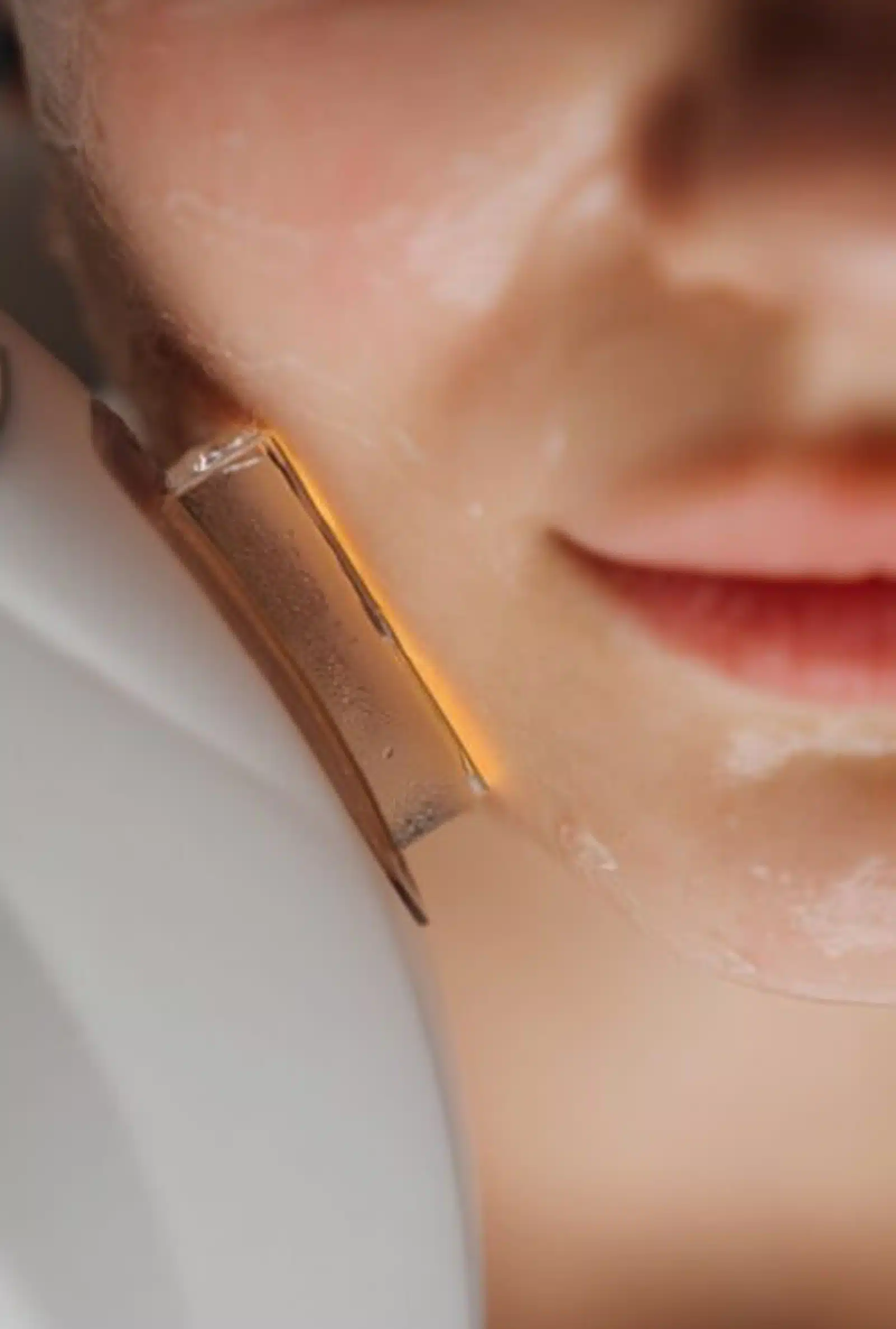 IPL Photofacial Procedure at Wymore Laser IPL Photofacial Procedure at Wymore Laser