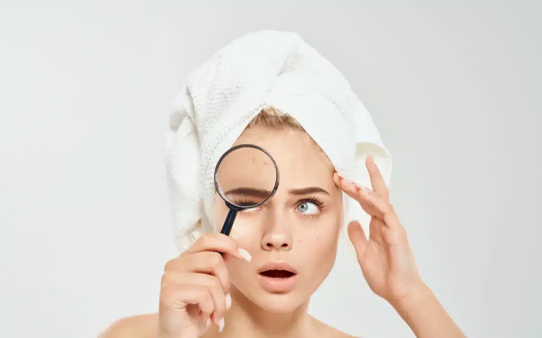 Laser Face Mark Removal