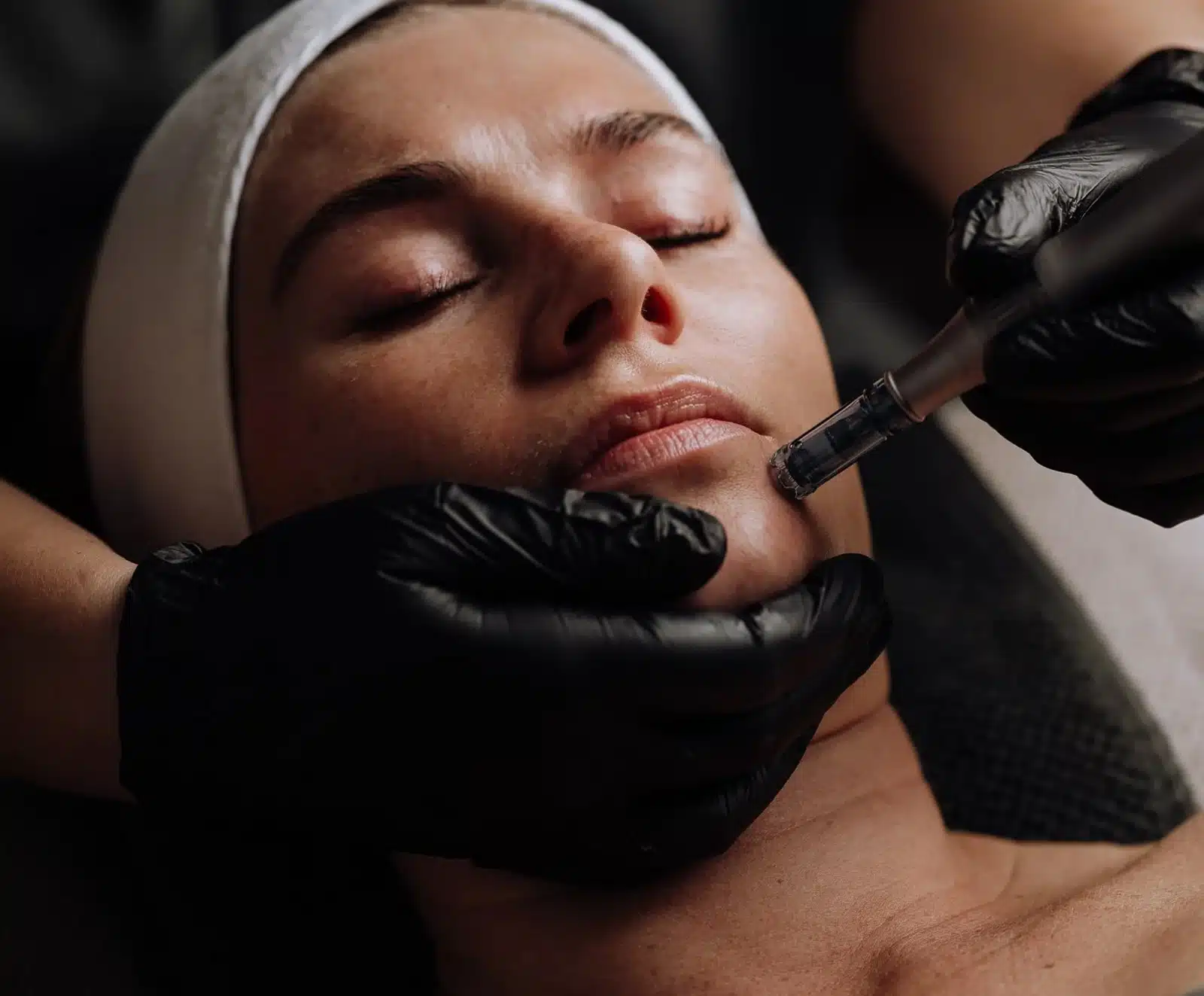 Post-Treatment Care Post-Treatment Care