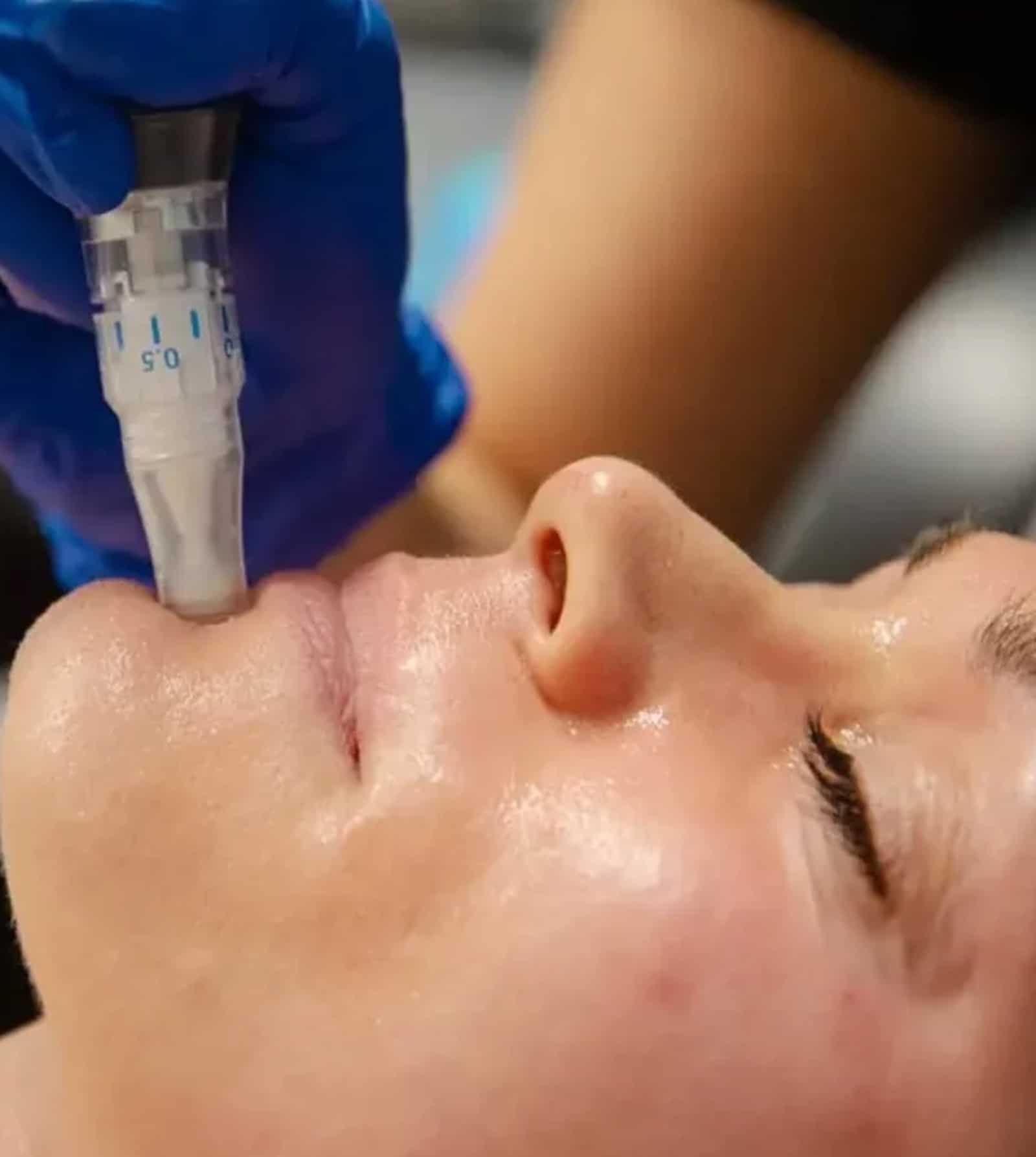 Transform Your Skin