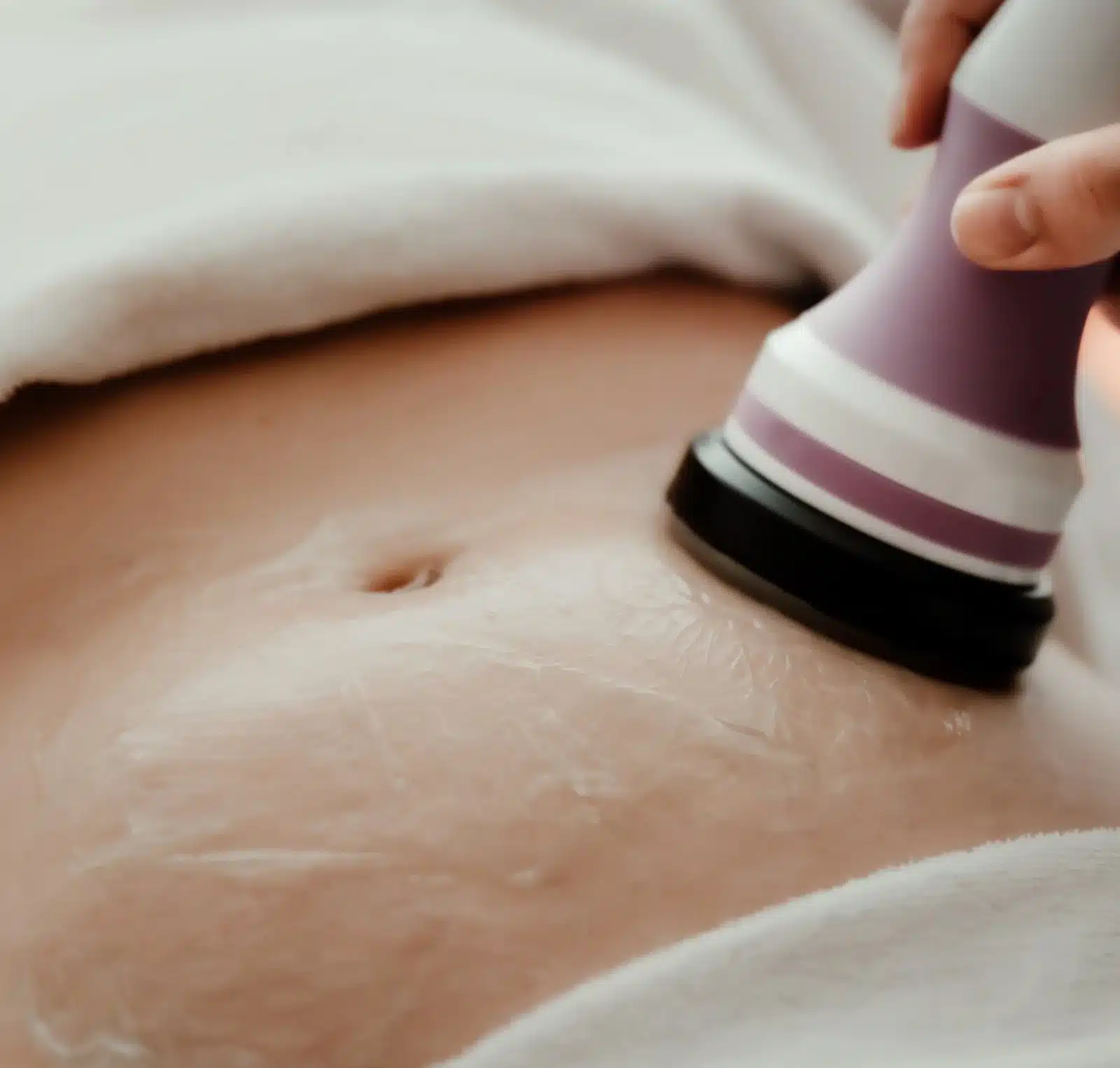 Treatment Experience at Wymore Laser Treatment Experience at Wymore Laser