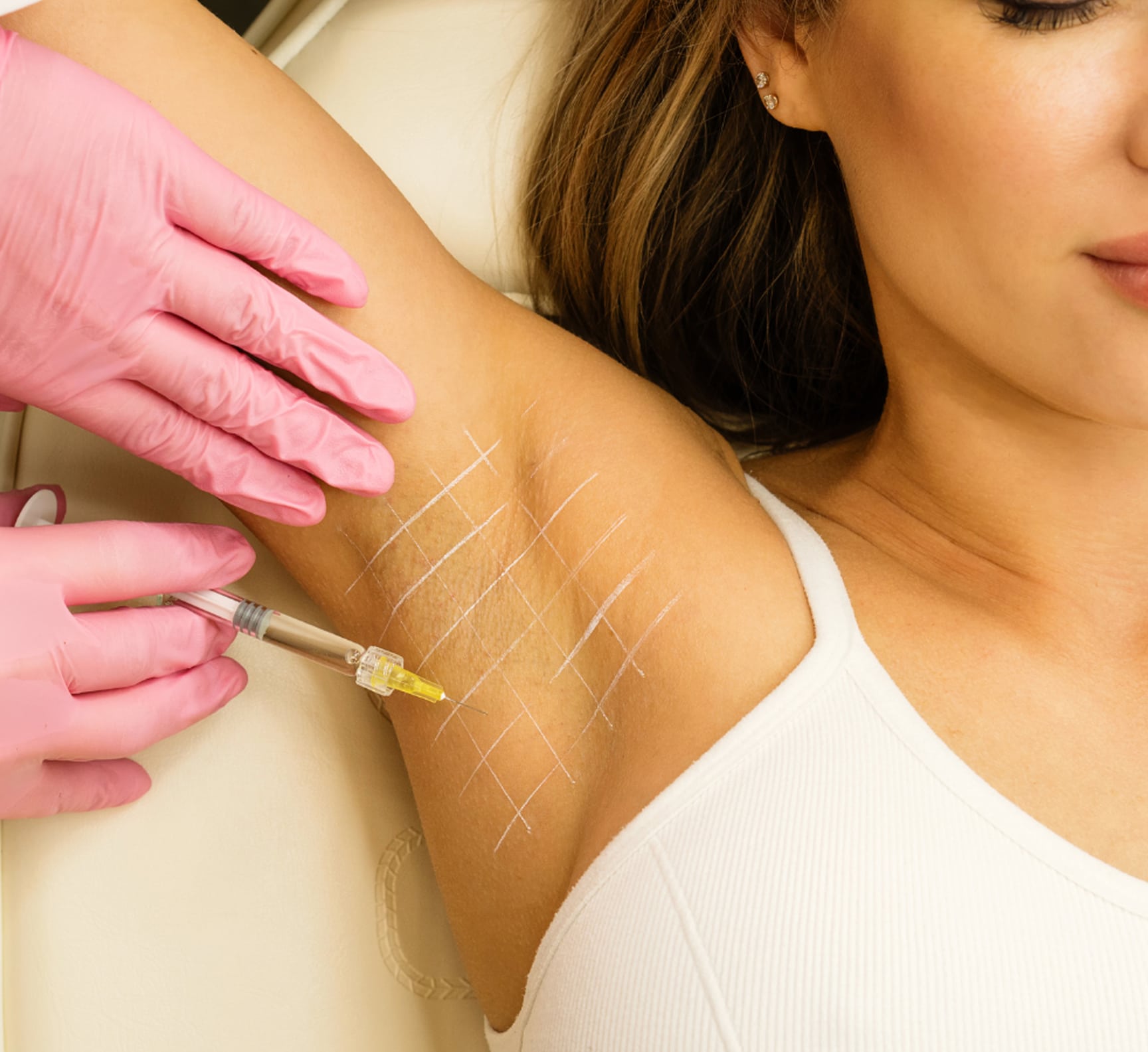 Expect During Treatment Expect During Treatment