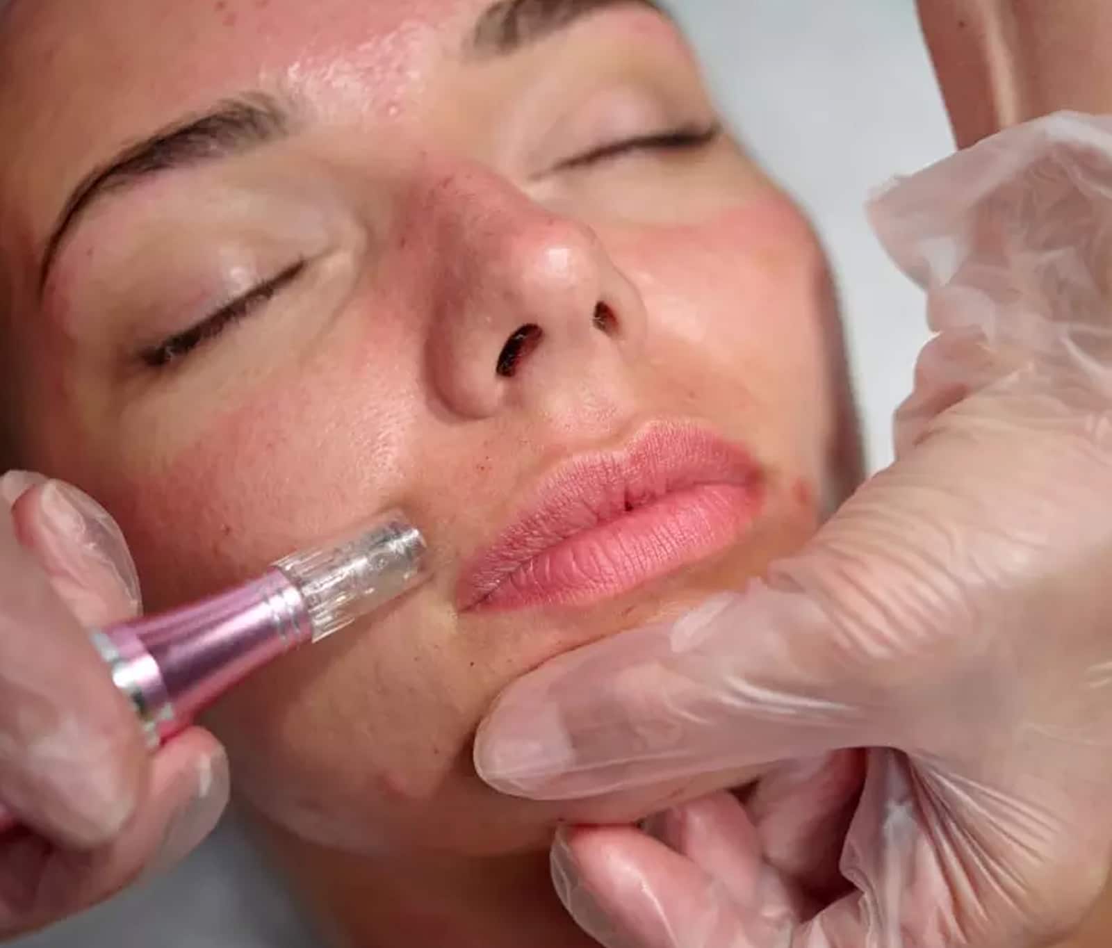 best results, complete 3 to 4 sessions best results, complete 3 to 4 sessions