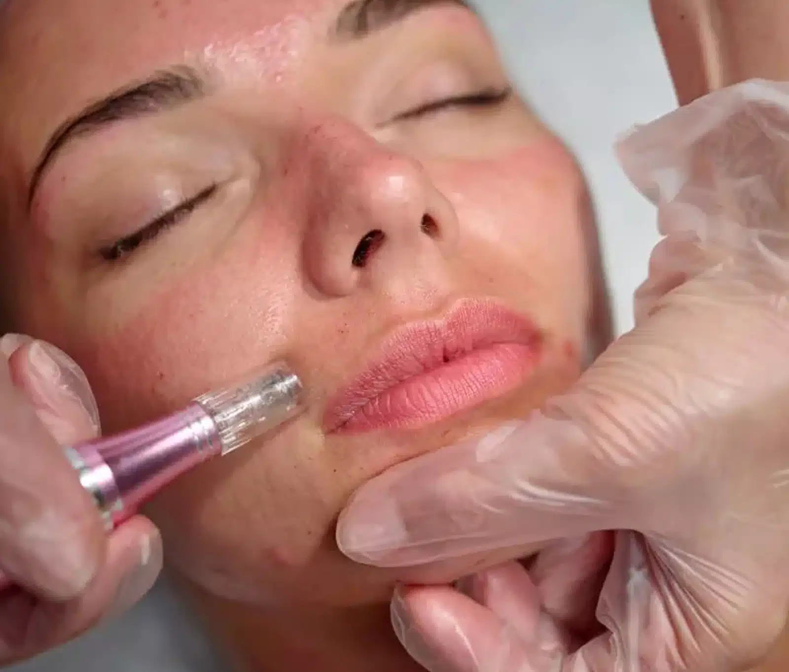 best results, complete 3 to 4 sessions best results, complete 3 to 4 sessions