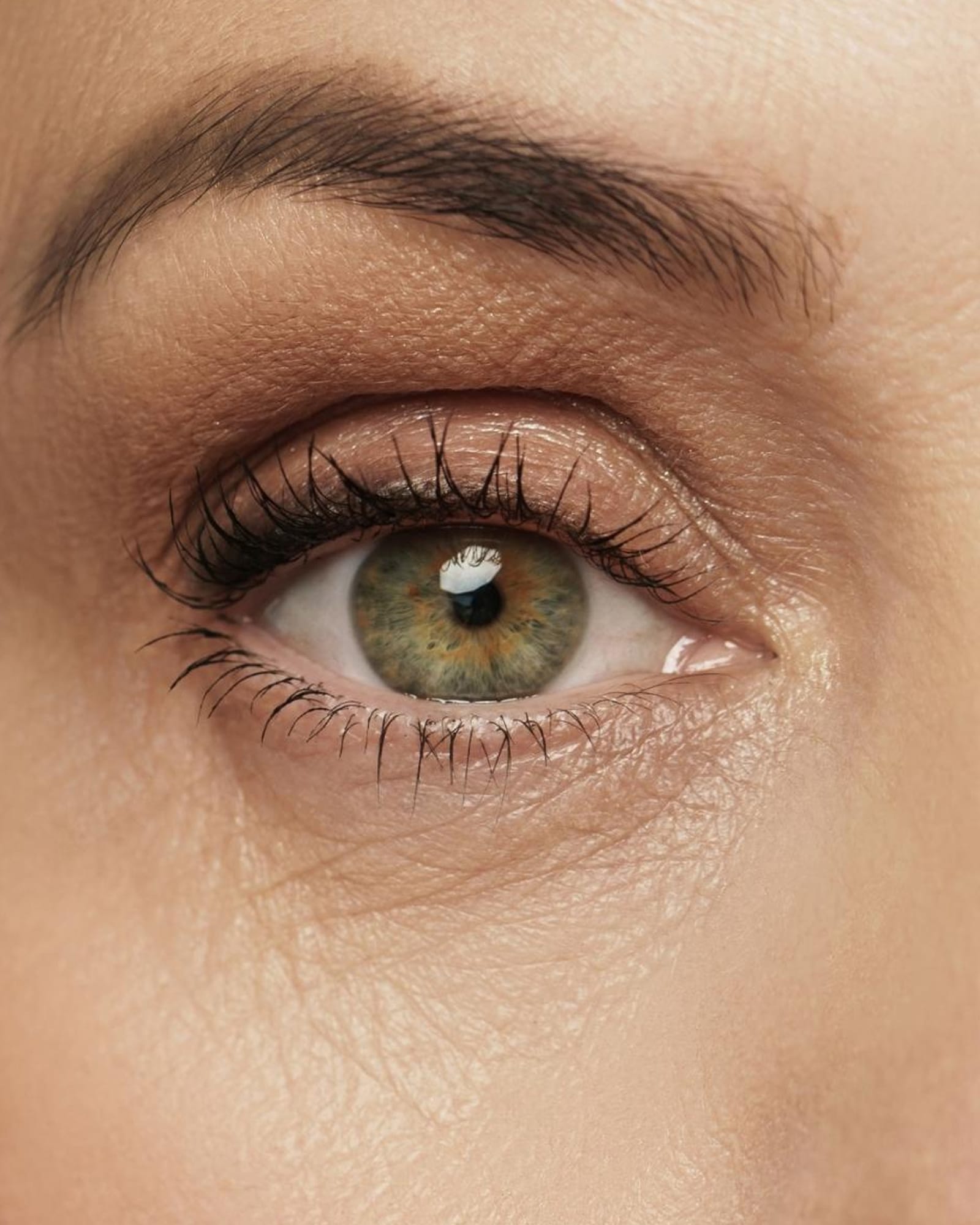 Causes Under-Eye Wrinkles Causes Under-Eye Wrinkles