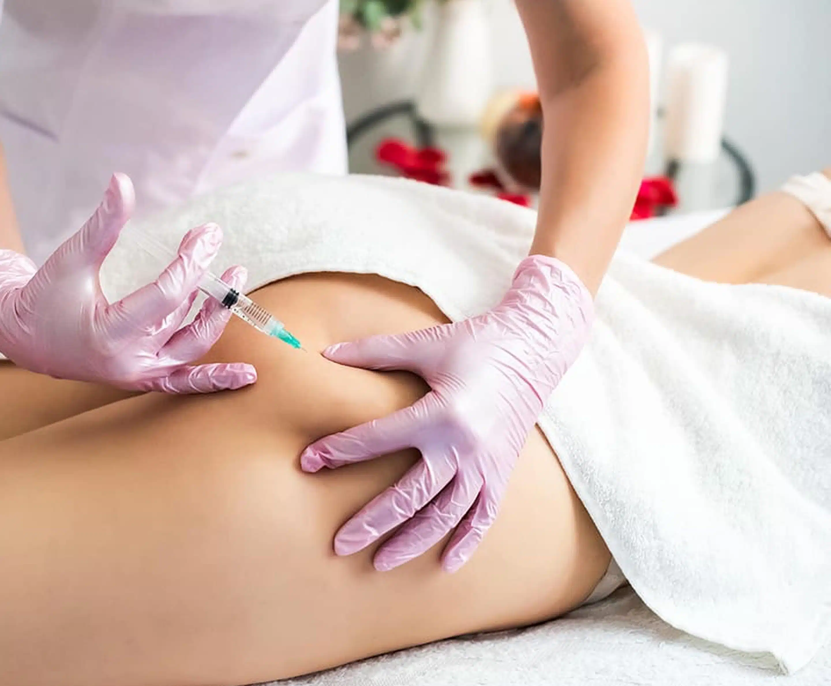 Cellulite Treatment in Orlando
