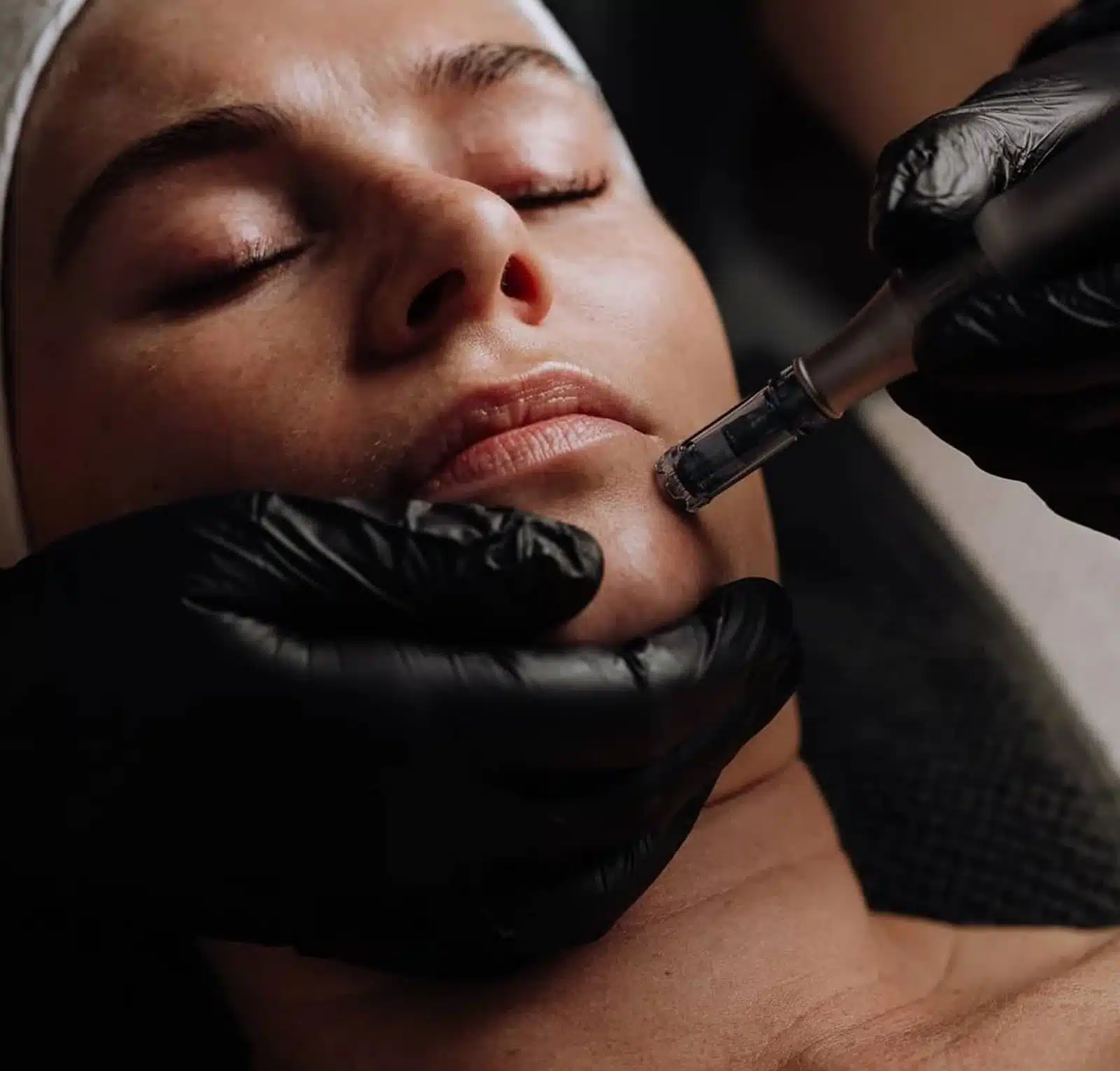RF Microneedling The Next Evolution of Skin Rejuvenation RF Microneedling The Next Evolution of Skin Rejuvenation