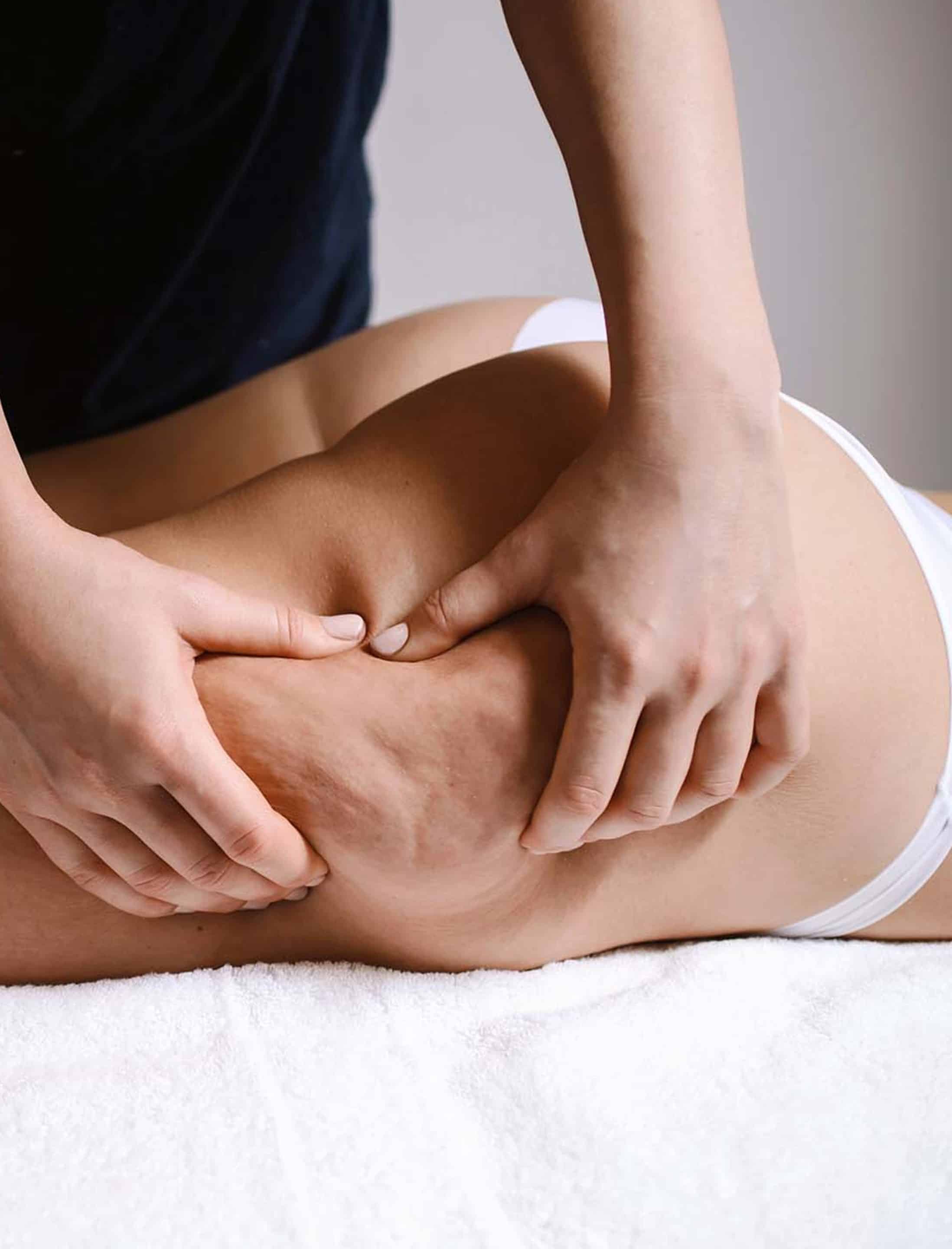 Understanding Cellulite