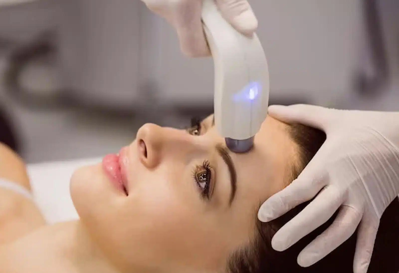 Benefit from IPL Rosacea Treatment Benefit from IPL Rosacea Treatment