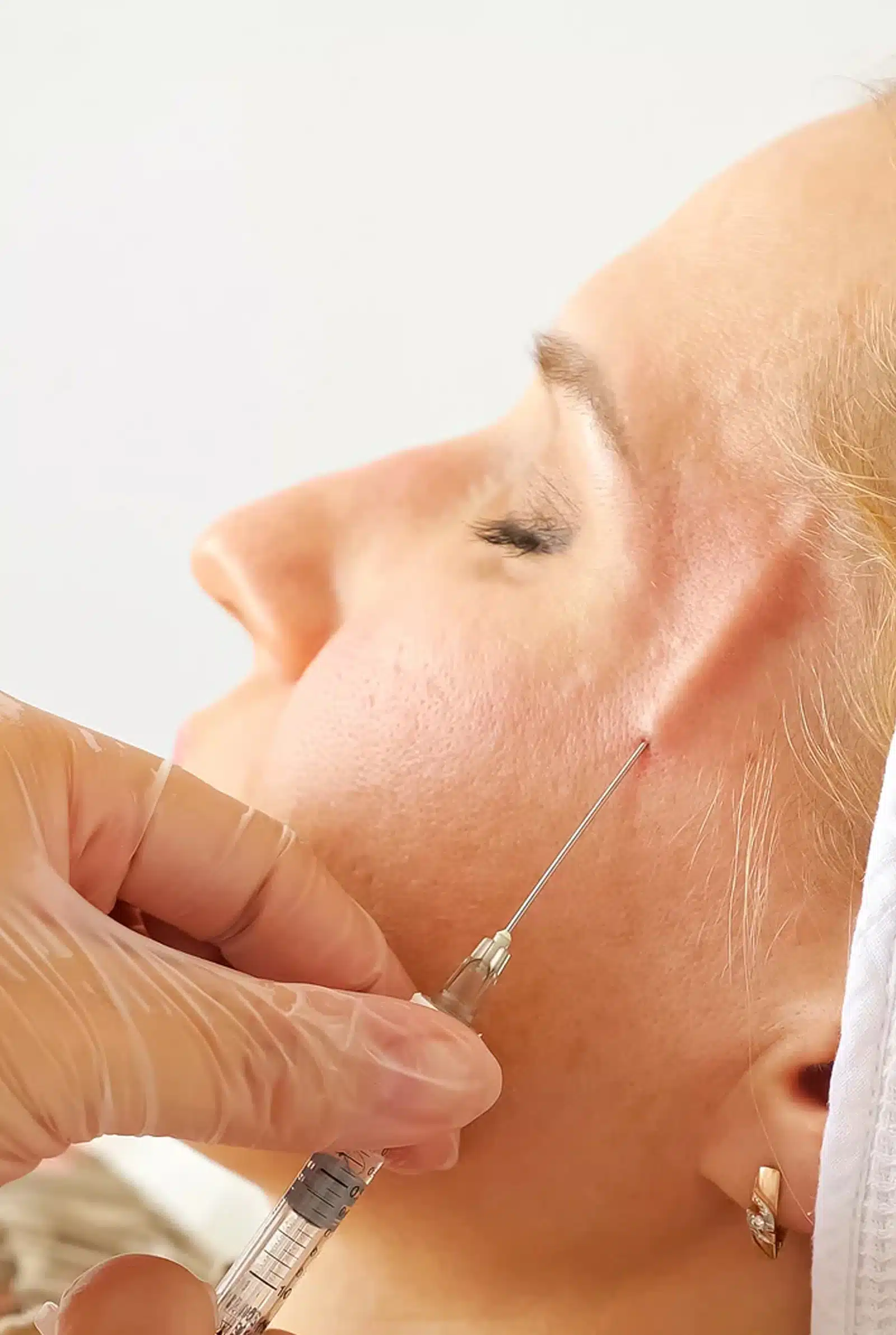 Benefits of Temple Fillers Benefits of Temple Fillers