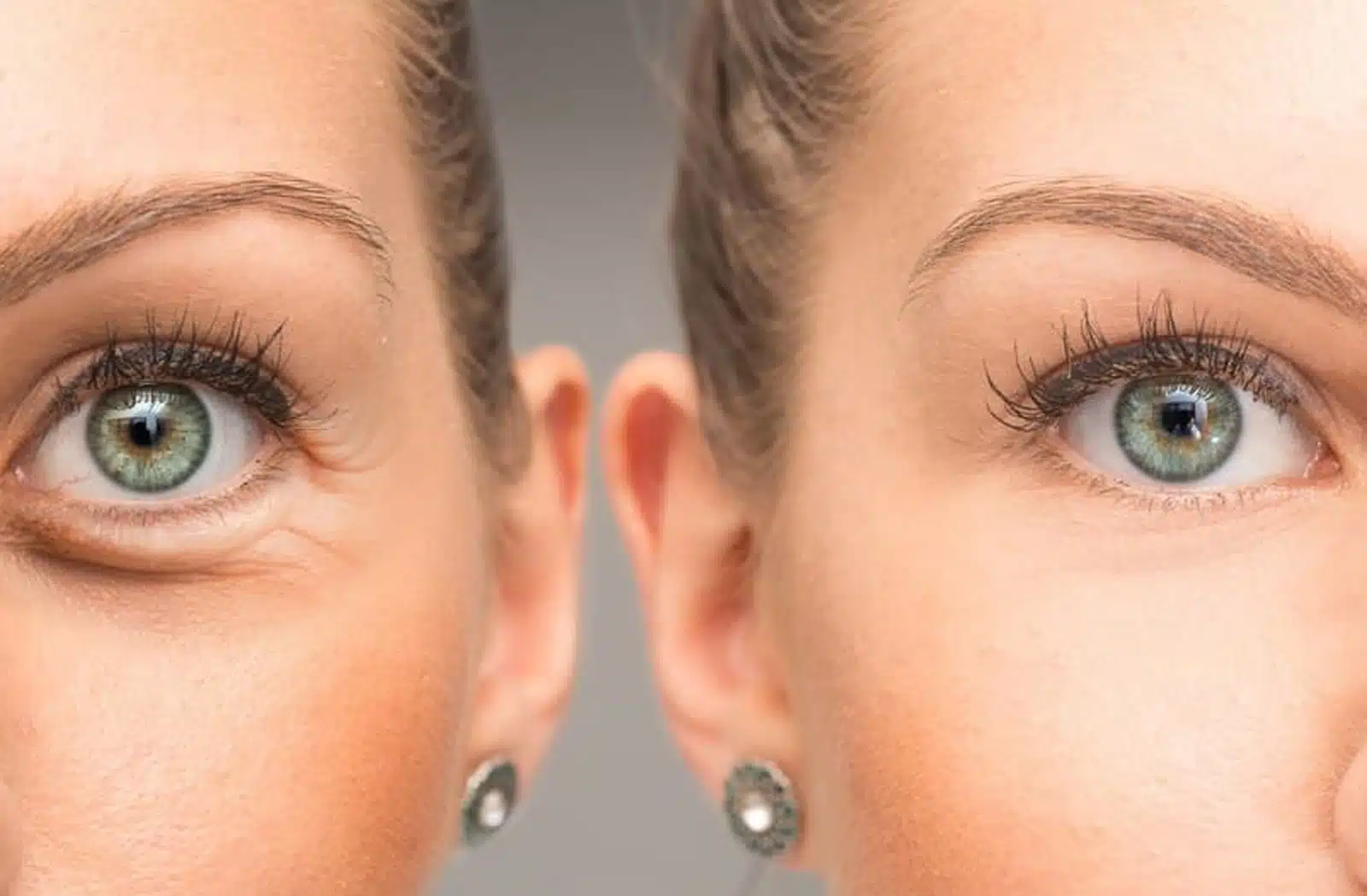 Combination Treatments Combination Treatments