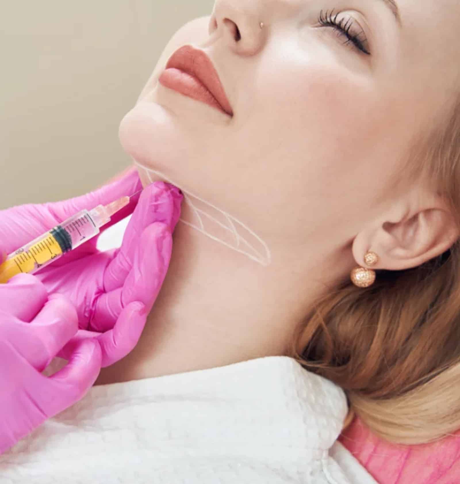 Dysport Treatment