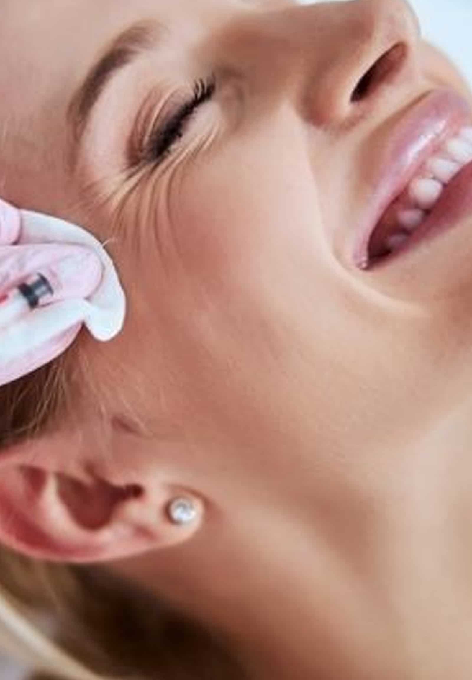 Dysport Works for Crow’s Feet