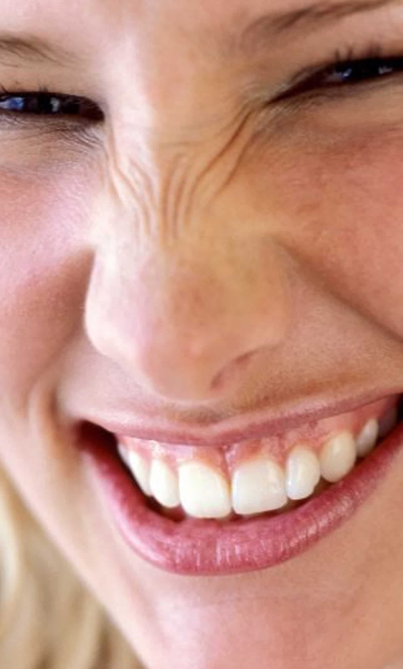 Dysport and Botox Dysport and Botox