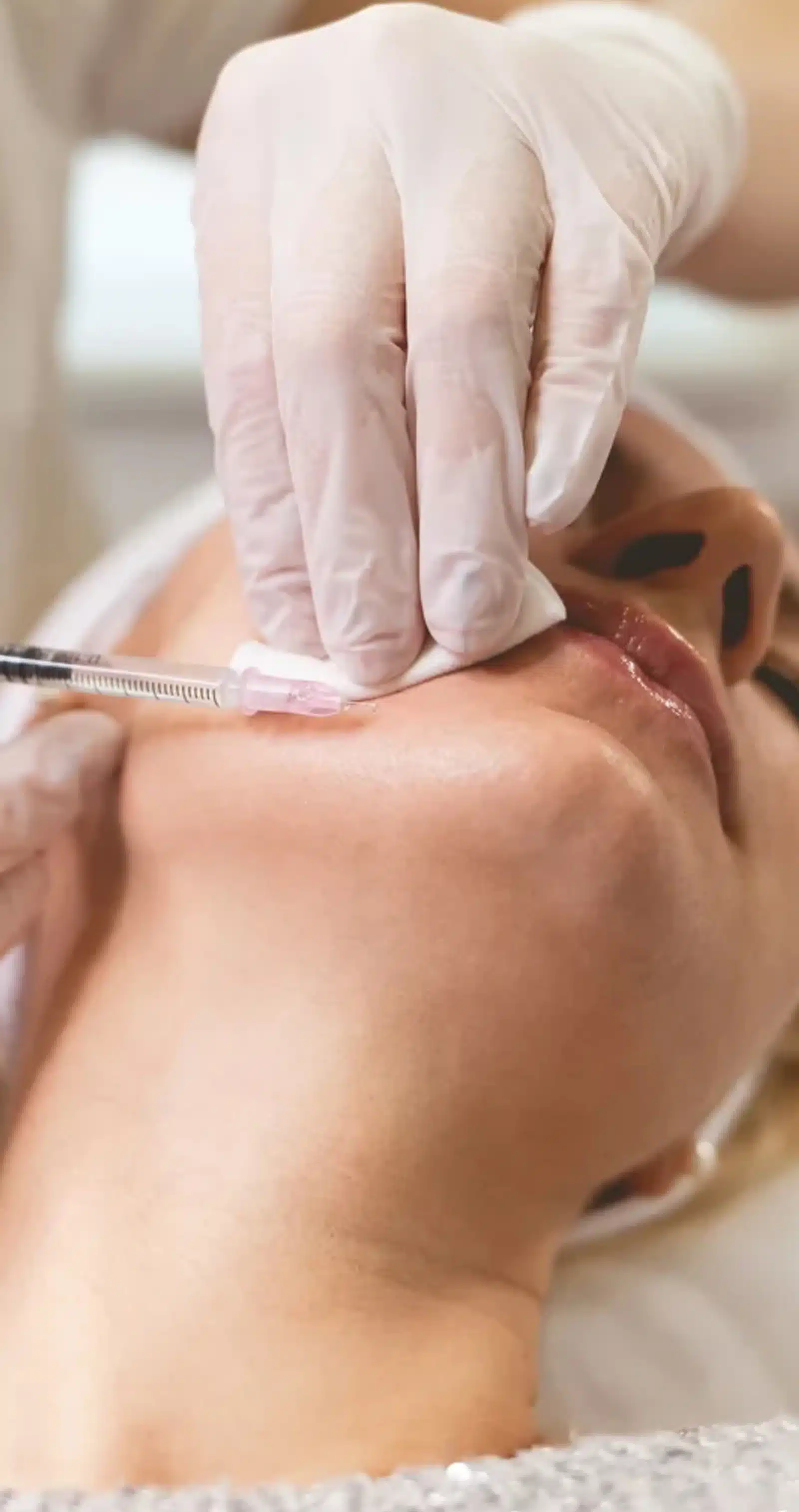 Jawline Fillers at Wymore Laser Jawline Fillers at Wymore Laser