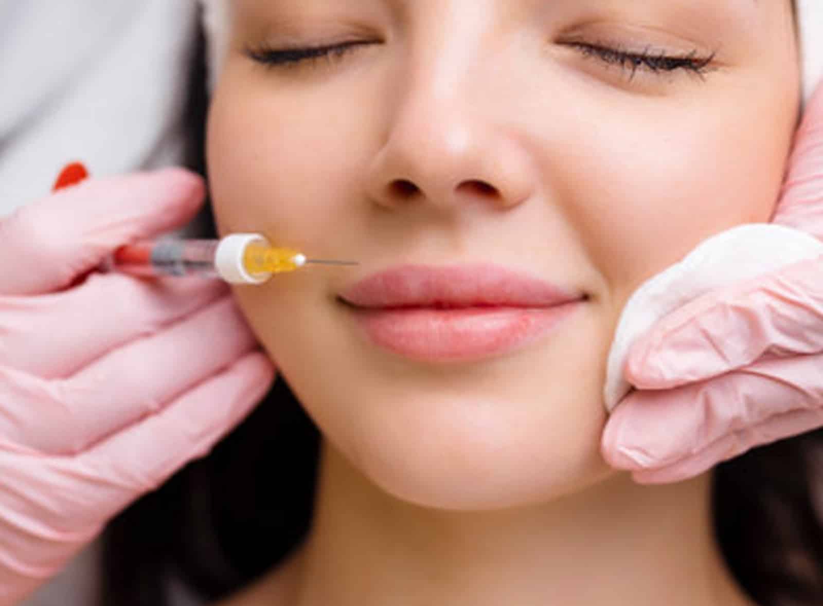 Lip Augmentation in Orlando Lip Augmentation in Orlando