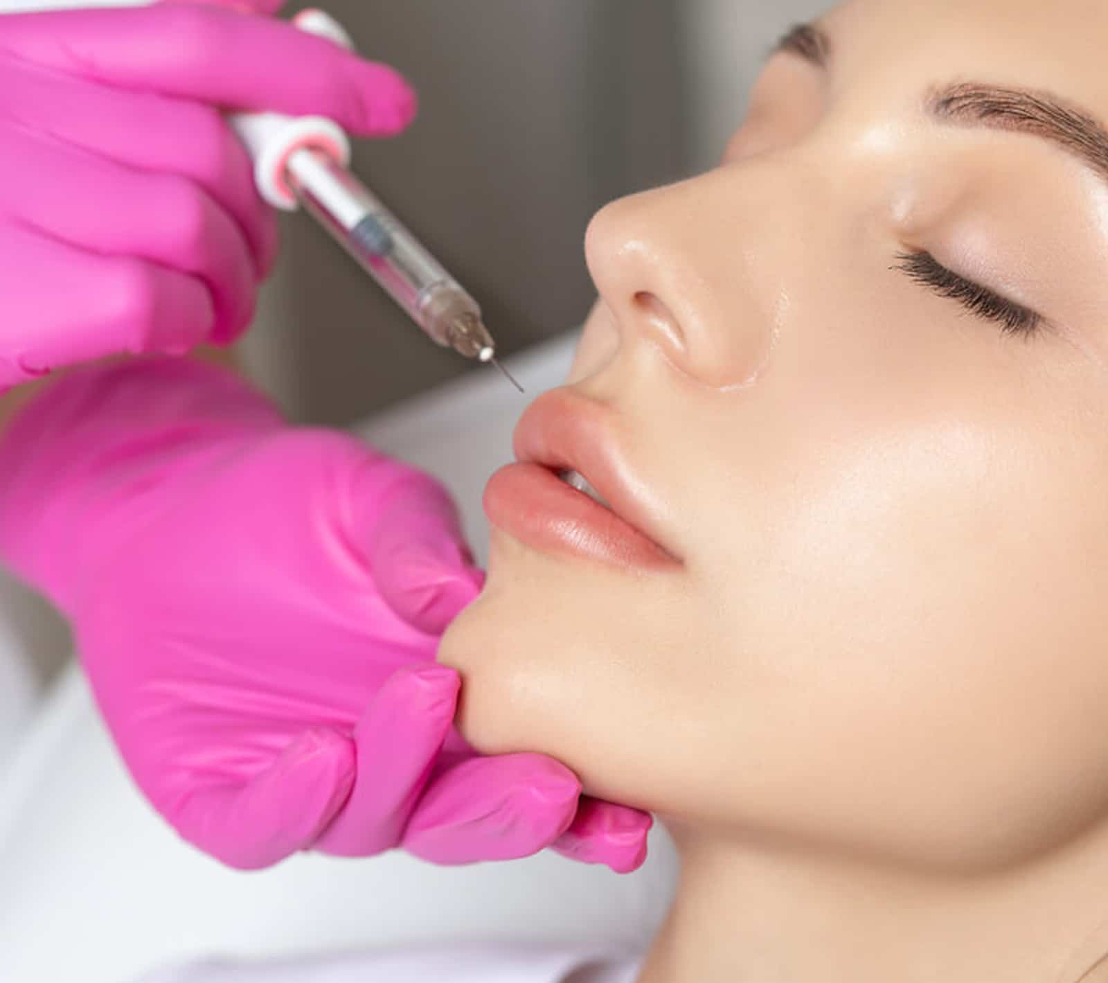 Lip Enhancement Lip Enhancement