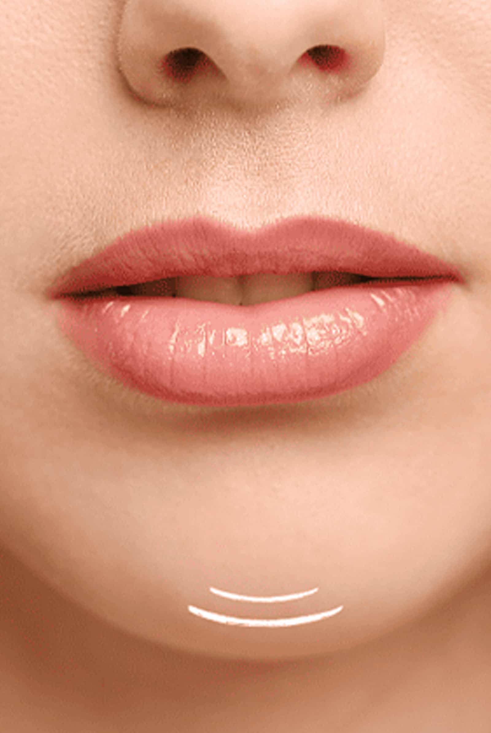 Non-Surgical Chin Smoothing