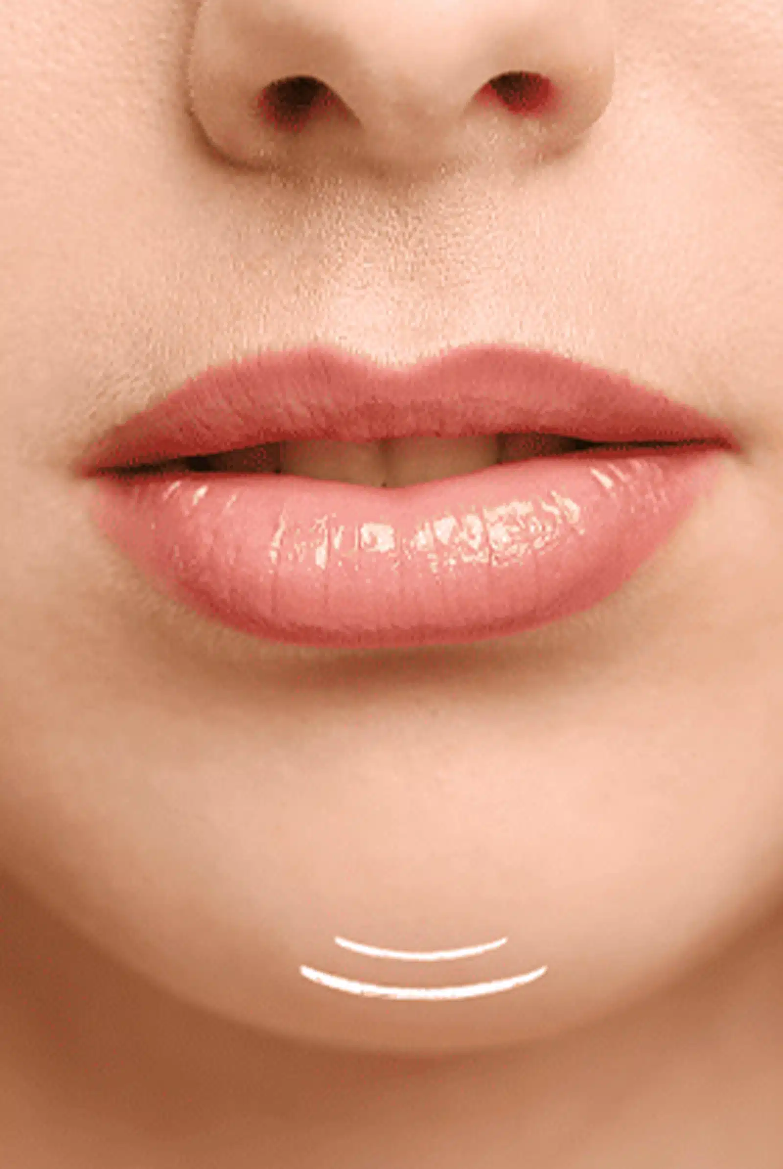 Non-Surgical Chin Smoothing