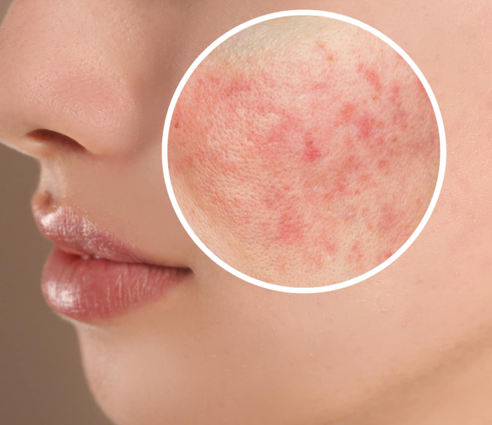 Personalized Treatment