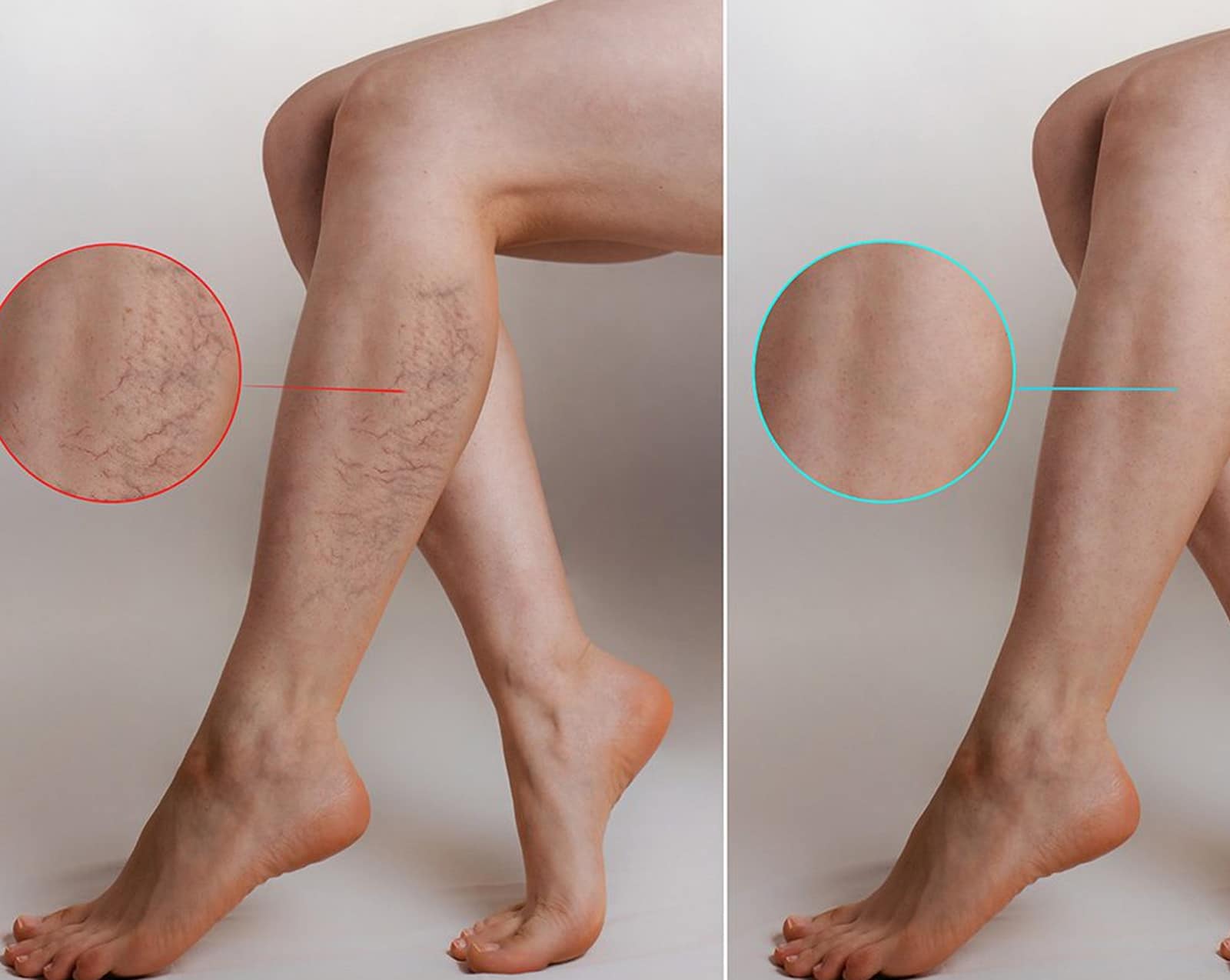 Post-Treatment Care and Recovery Post-Treatment Care and Recovery