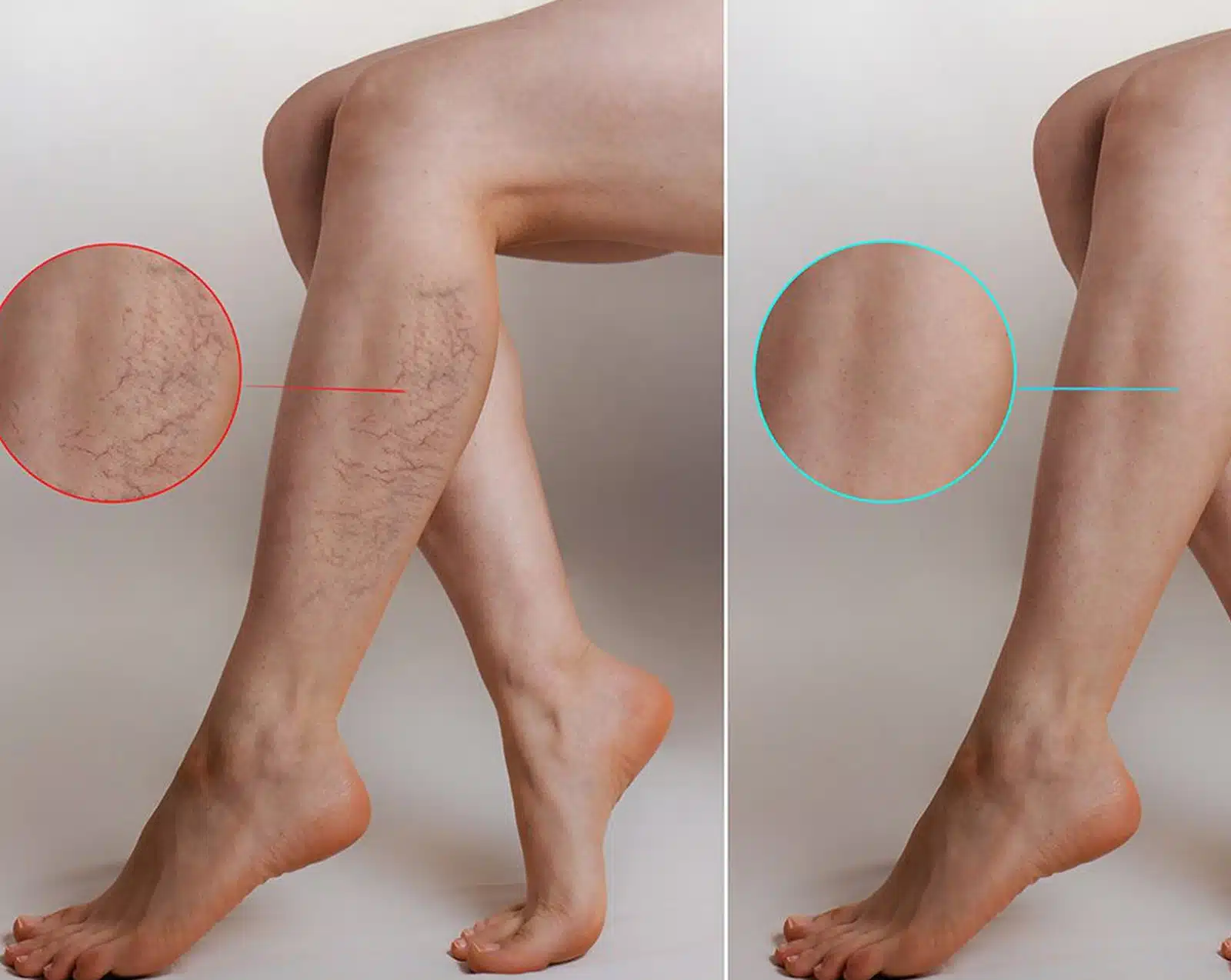 Post-Treatment Care and Recovery Post-Treatment Care and Recovery