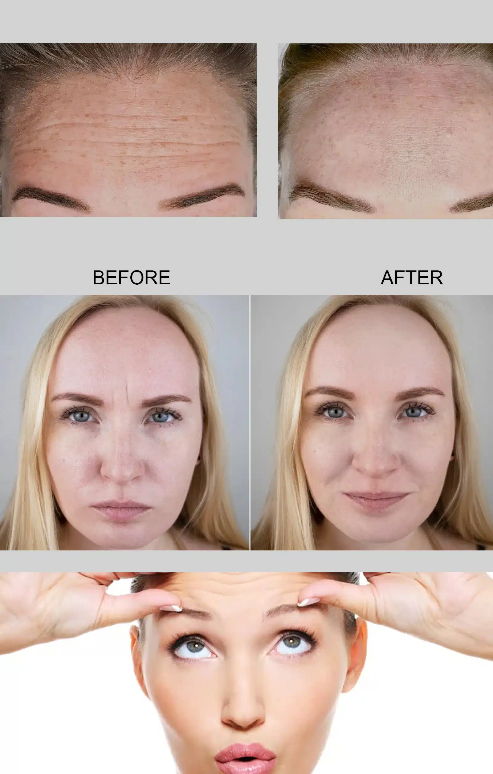 Post-Treatment Guidance