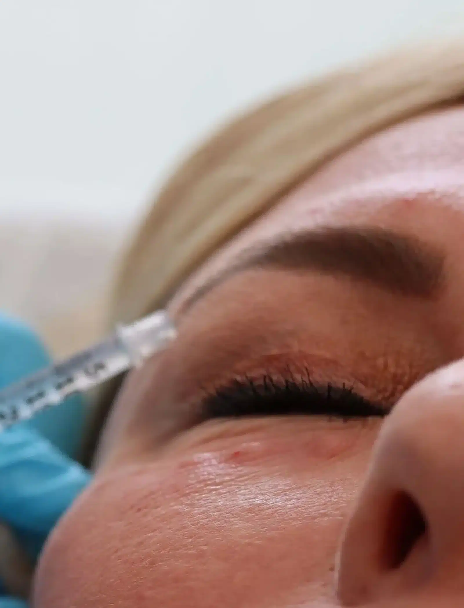 Prevents Future Wrinkles Prevents Future Wrinkles