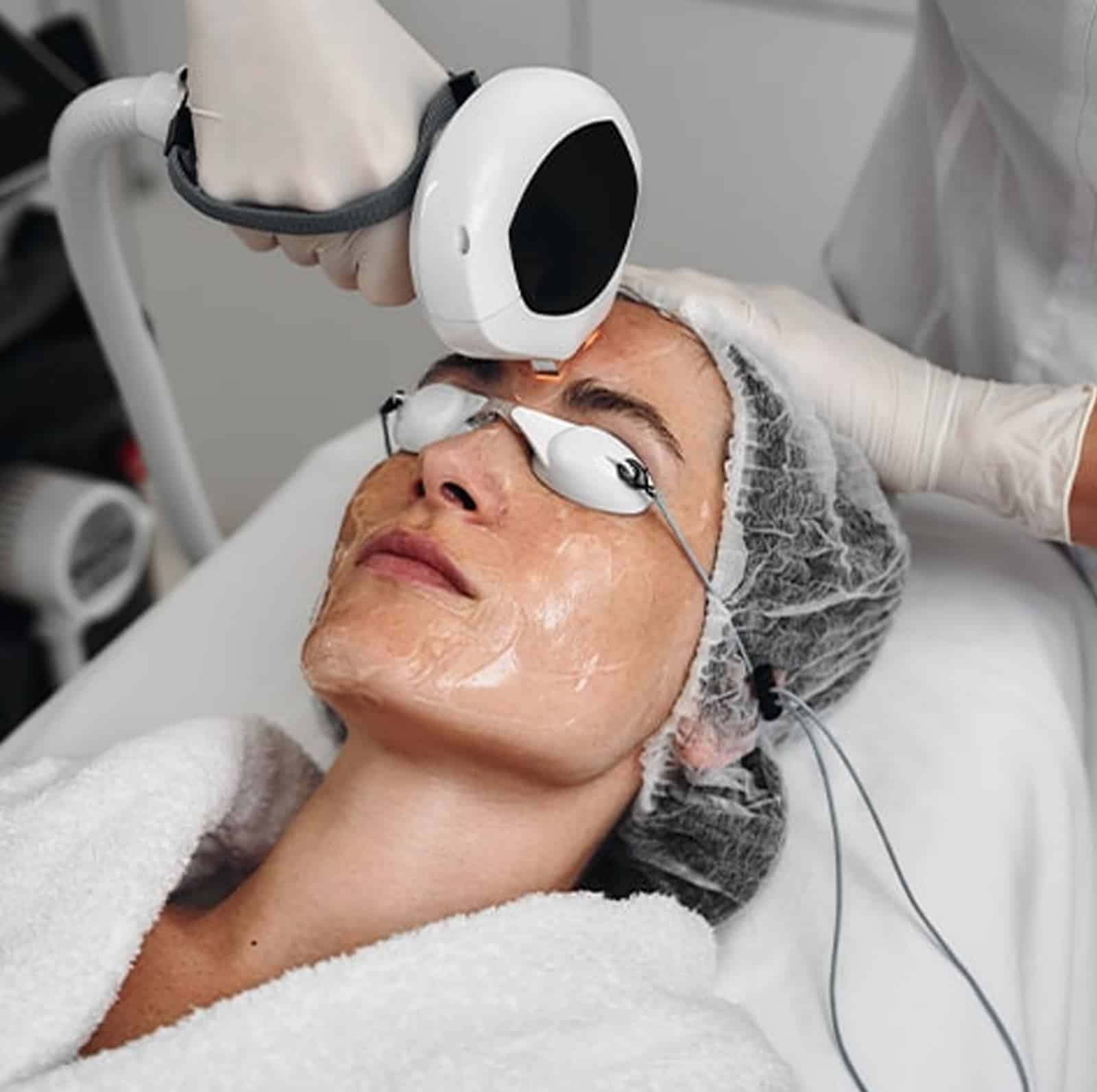 Professional Rosacea Treatment