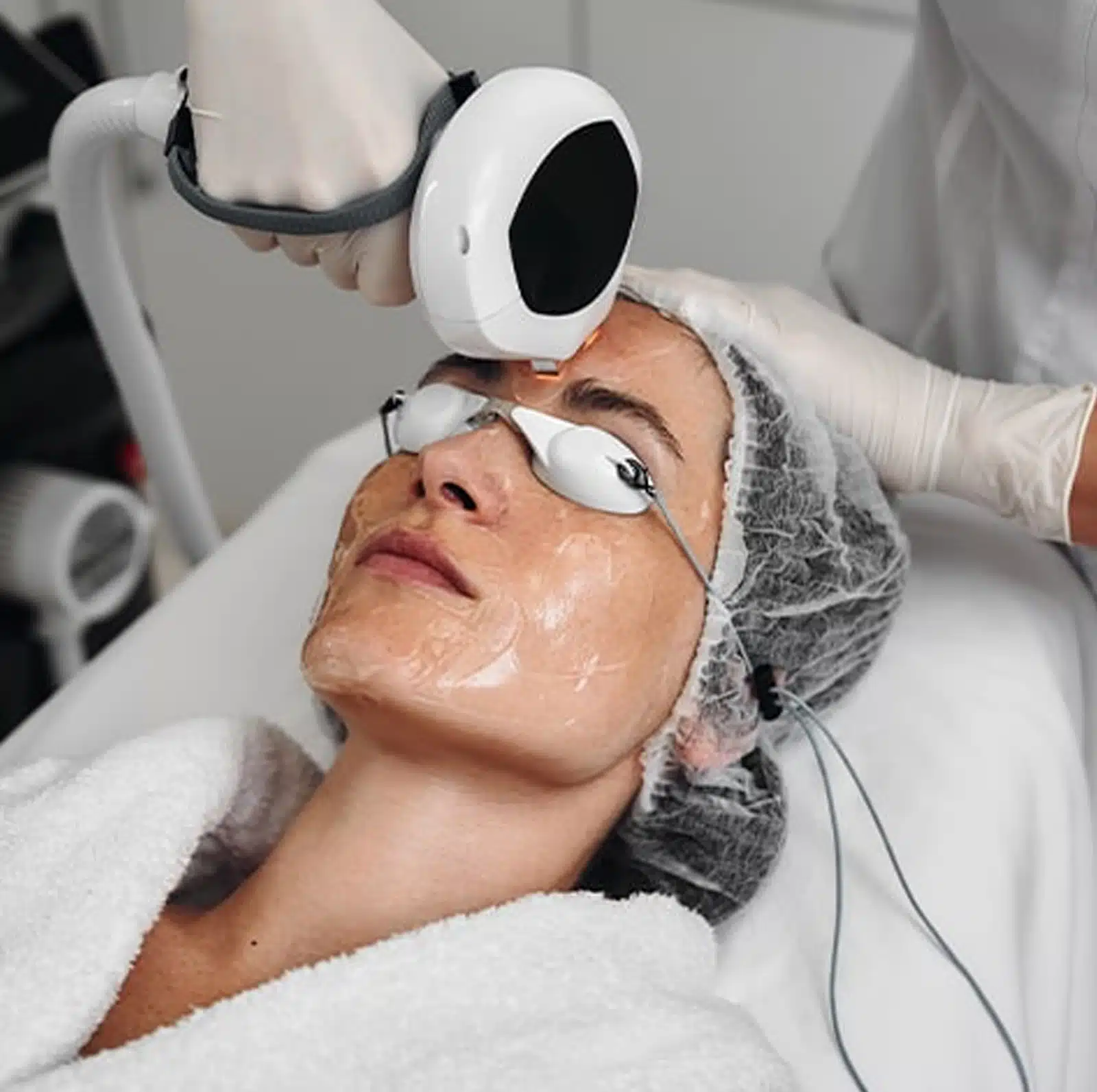 Professional Rosacea Treatment Professional Rosacea Treatment