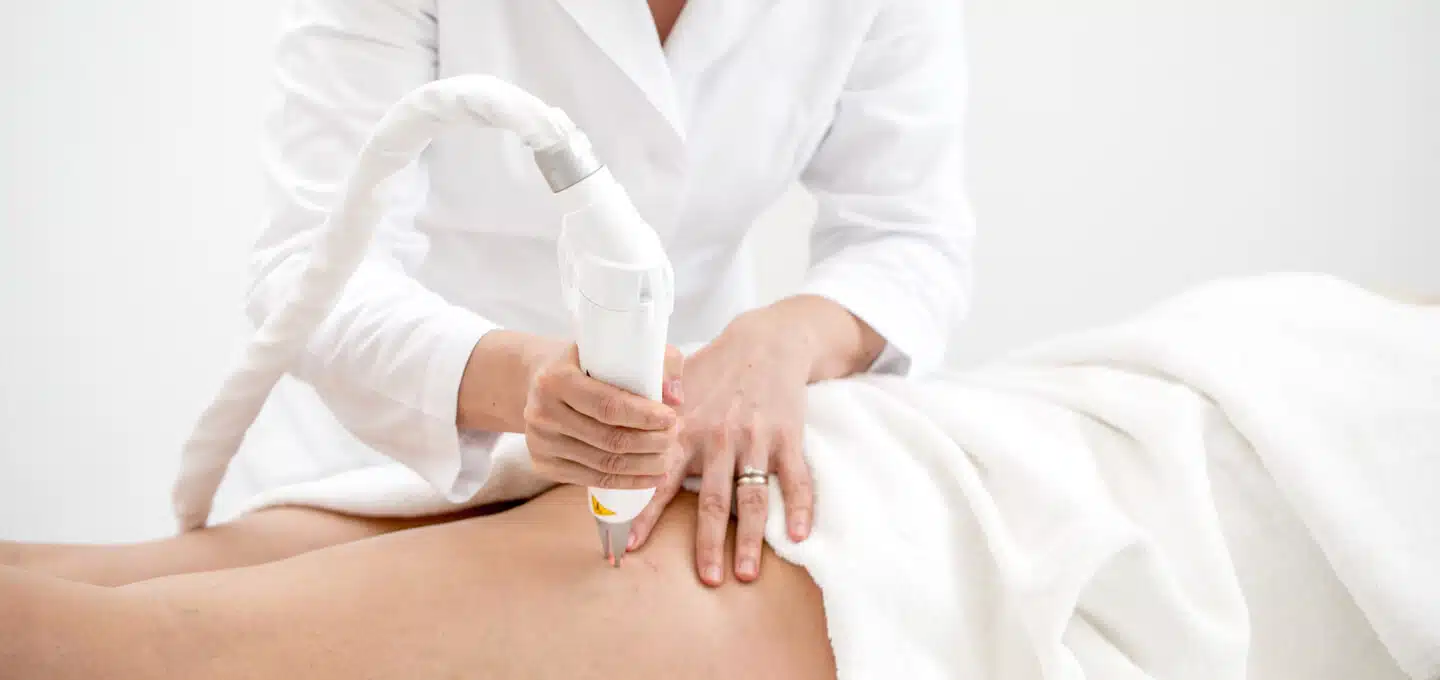 Professional Vein Treatment Near Me Orlando