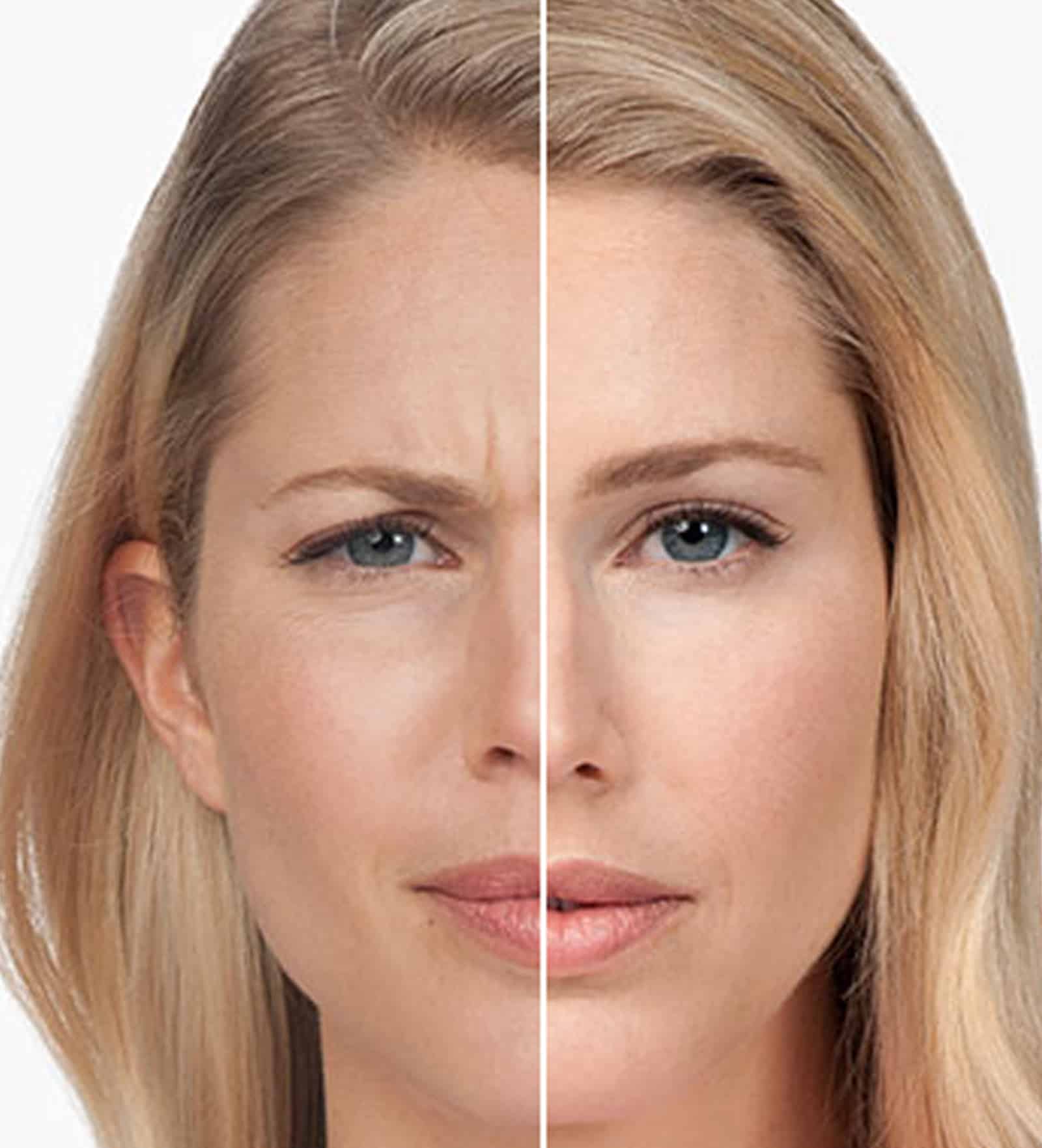 Quick & Precise Injections Comfortable Treatment