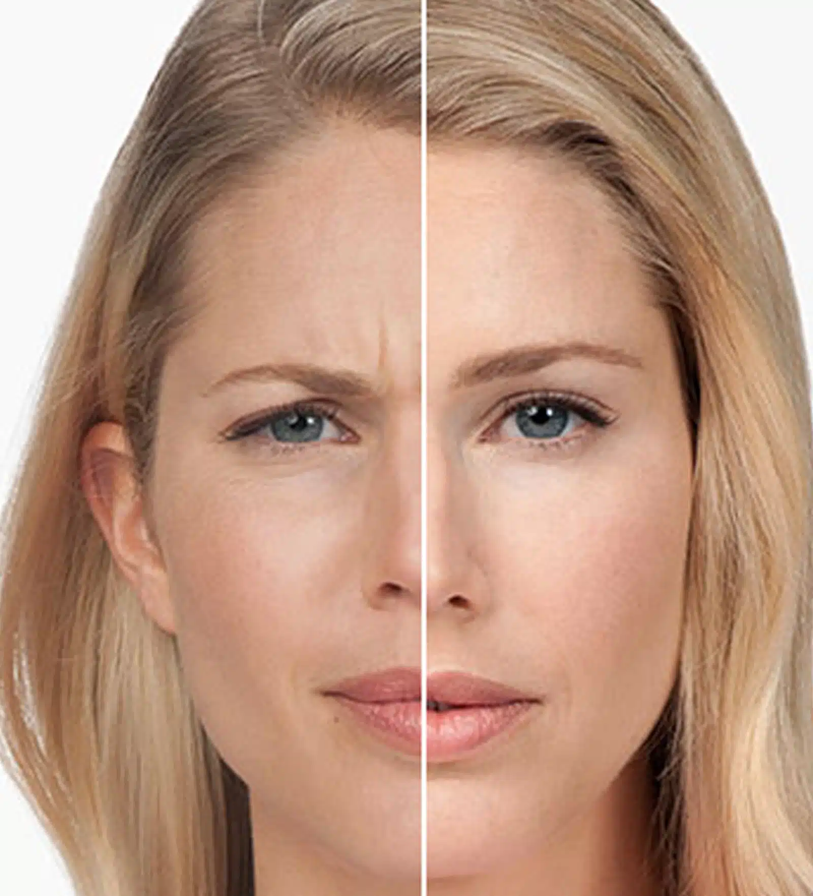 Quick & Precise Injections Comfortable Treatment