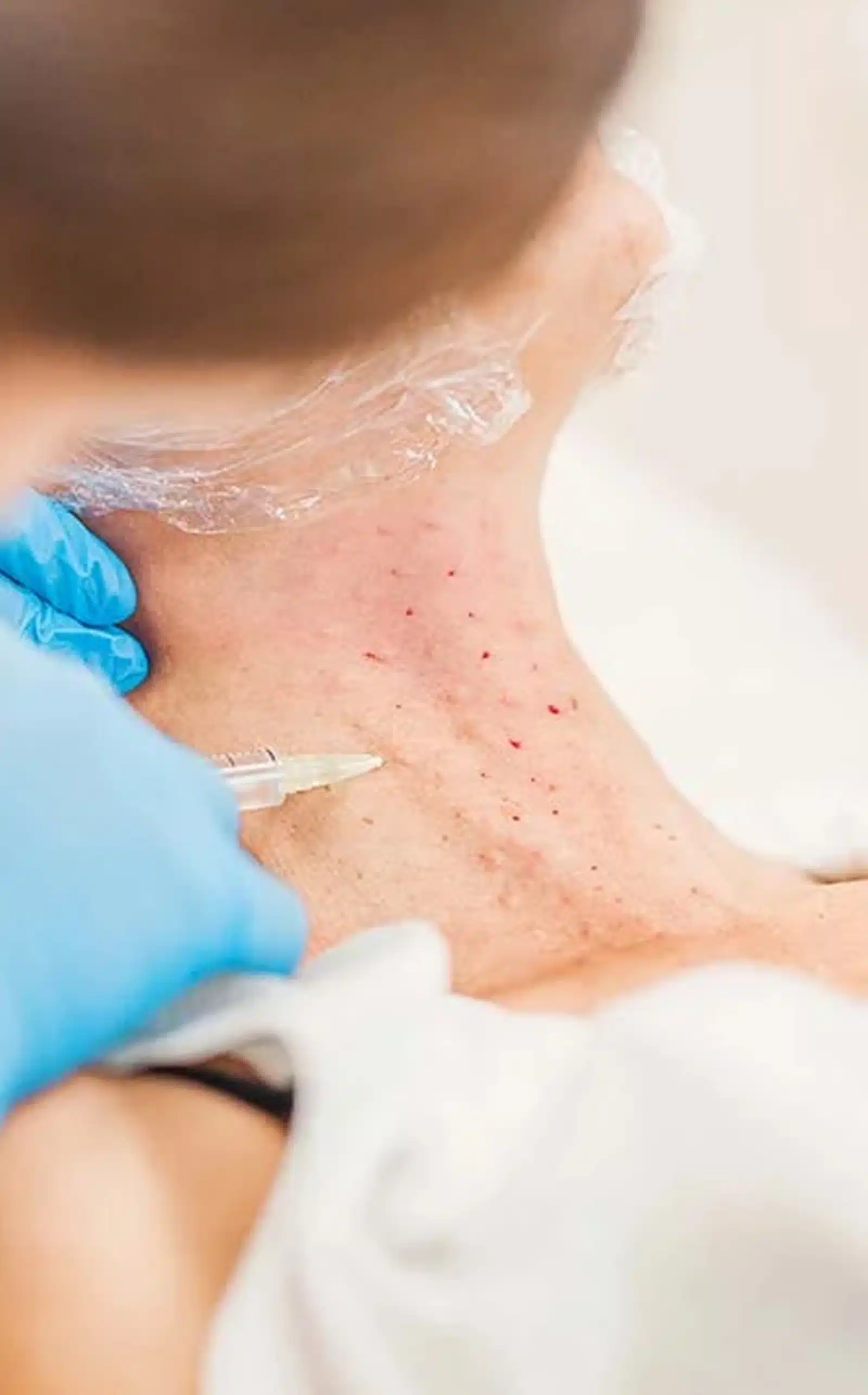 Reclaim a Smoother Reclaim a Smoother