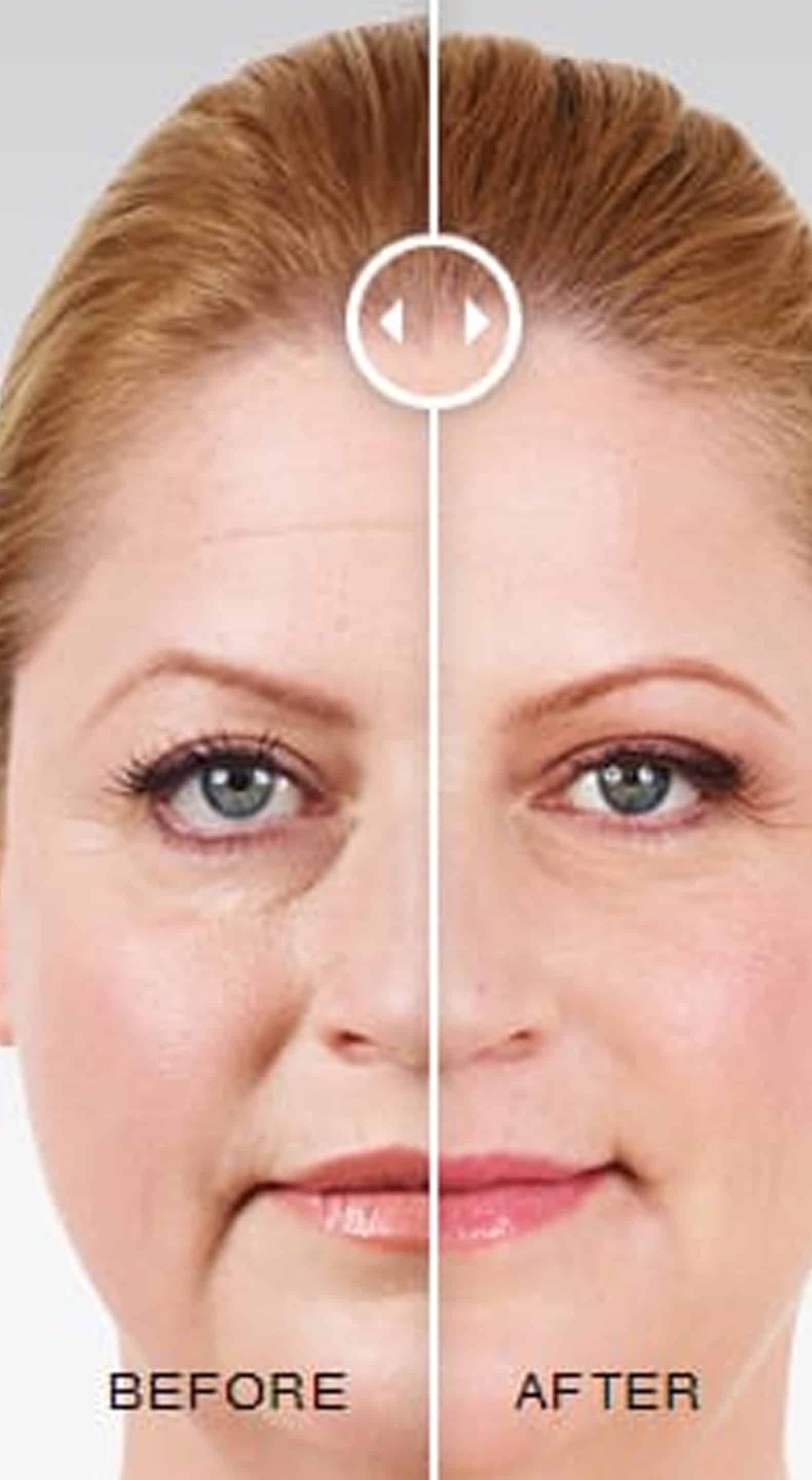 Recovery and Aftercare