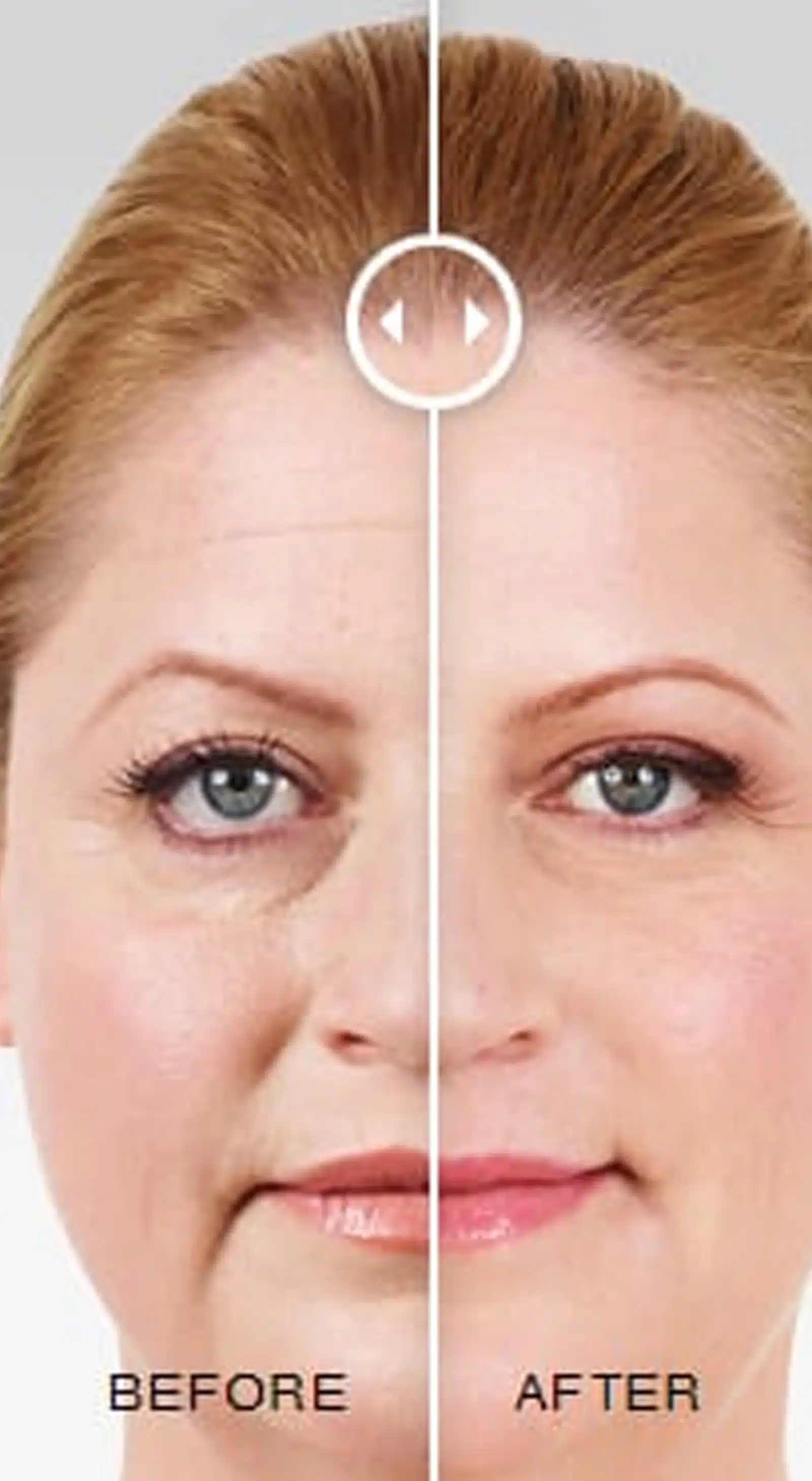 Recovery and Aftercare Recovery and Aftercare