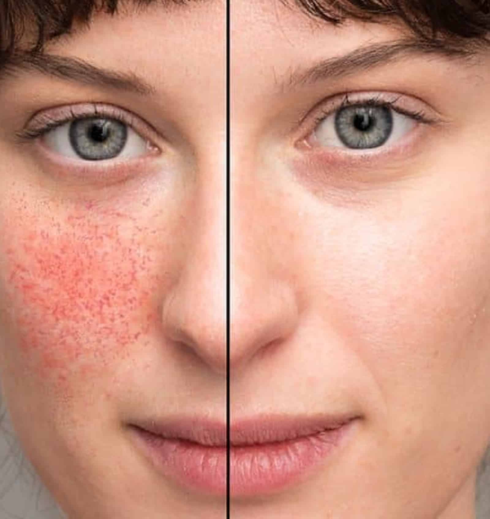 Rediscover Radiant Skin