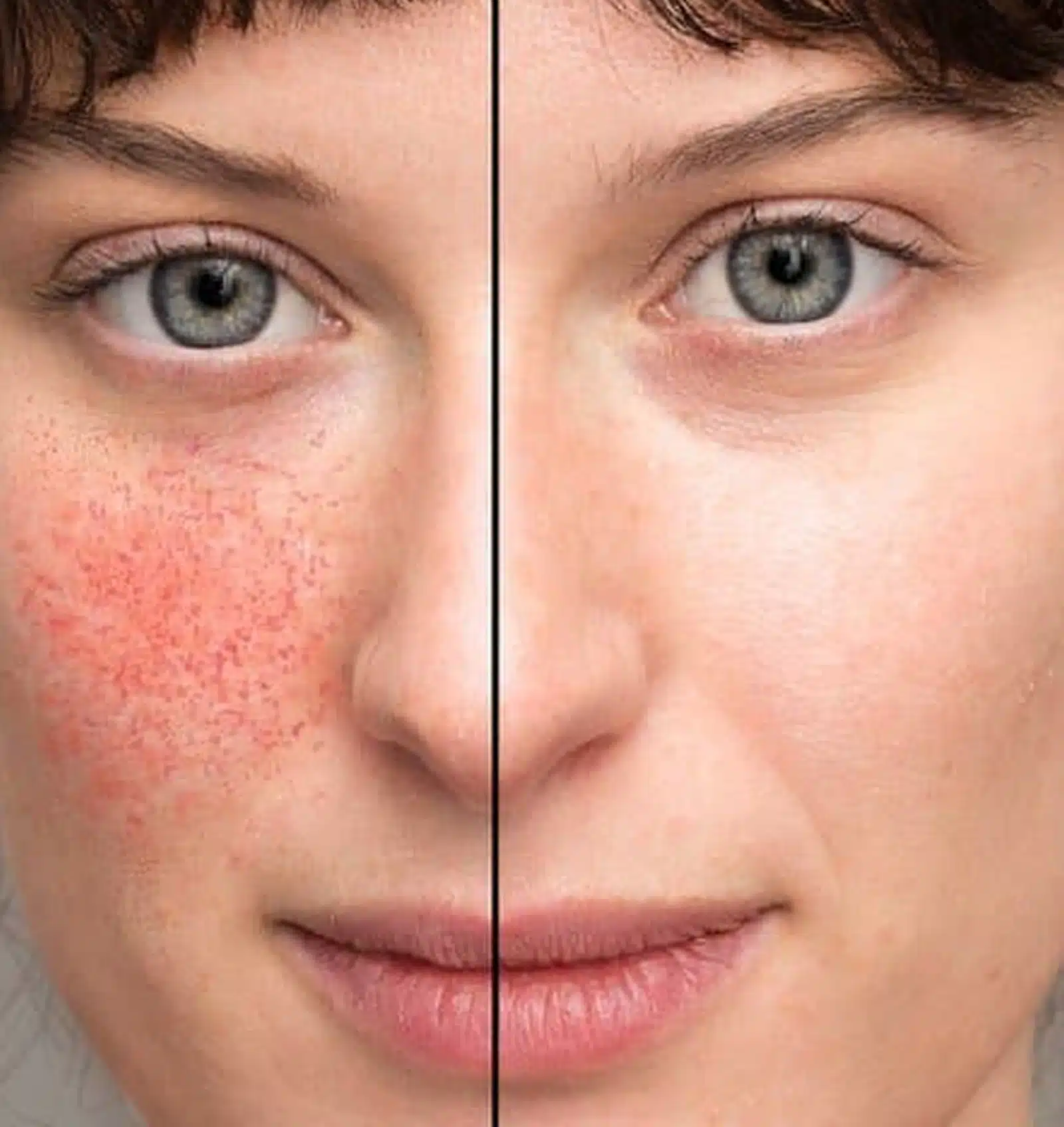 Rediscover Radiant Skin