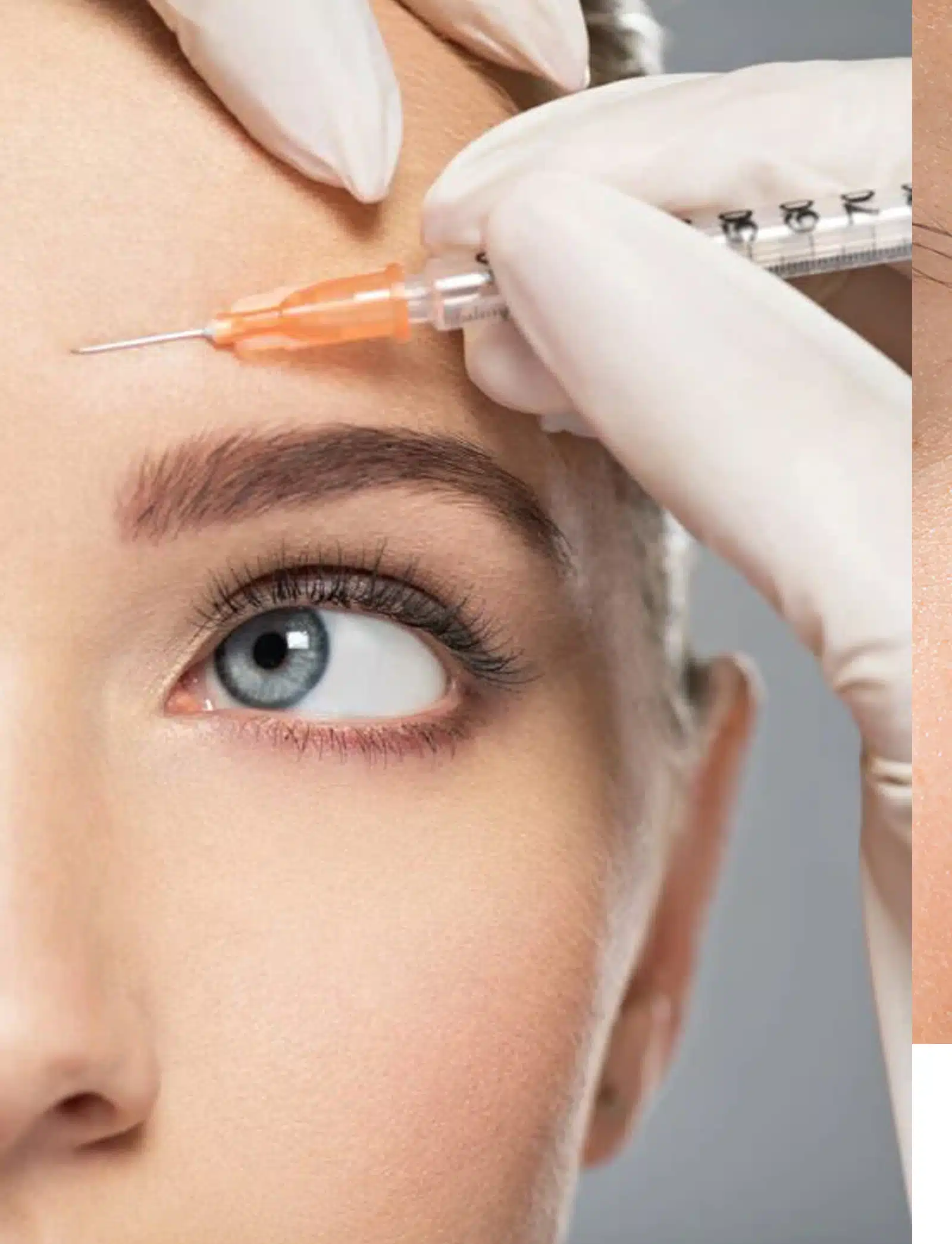 Reduce Eye Wrinkles Quickly