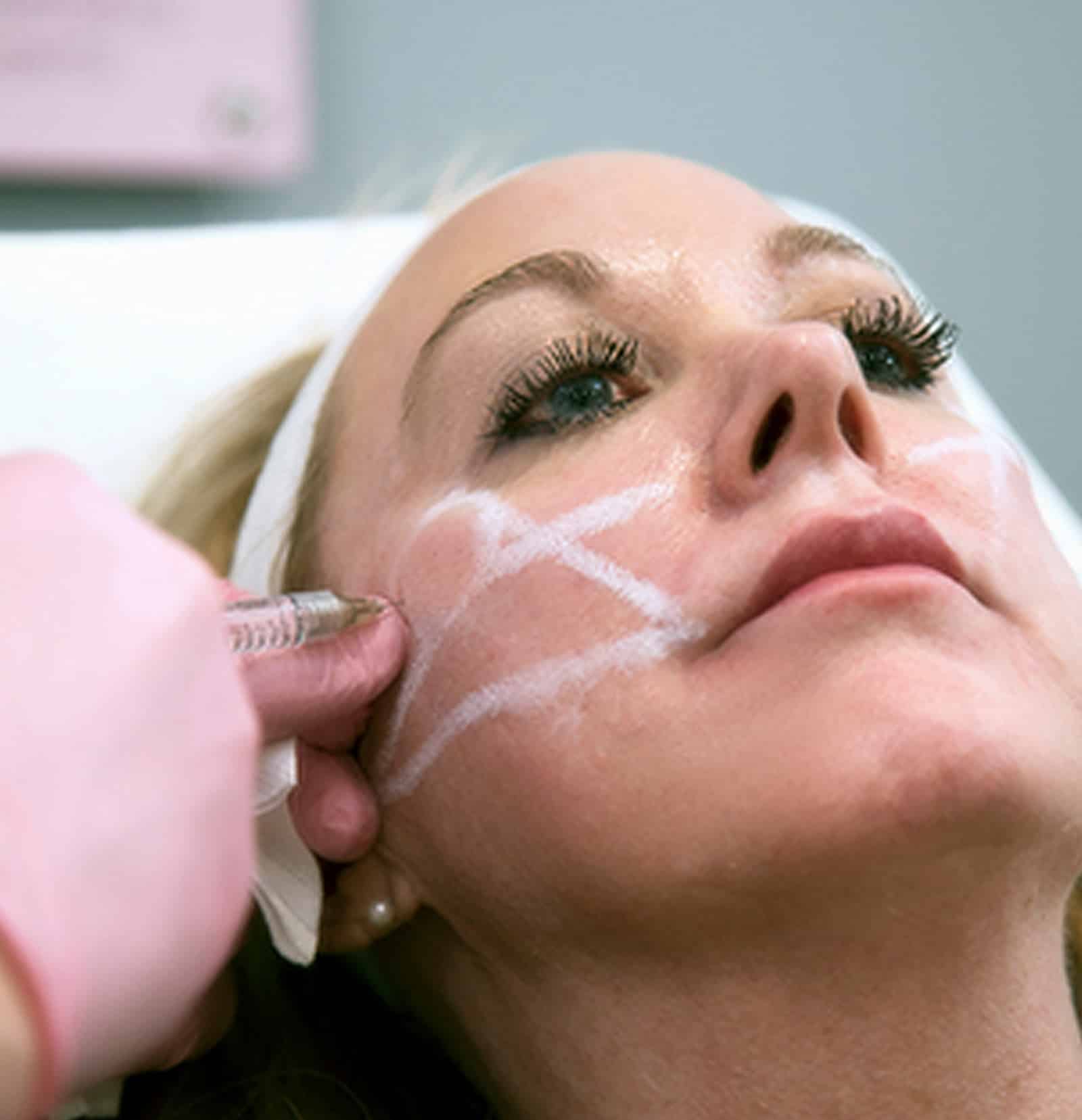 Restored Youthful Volume