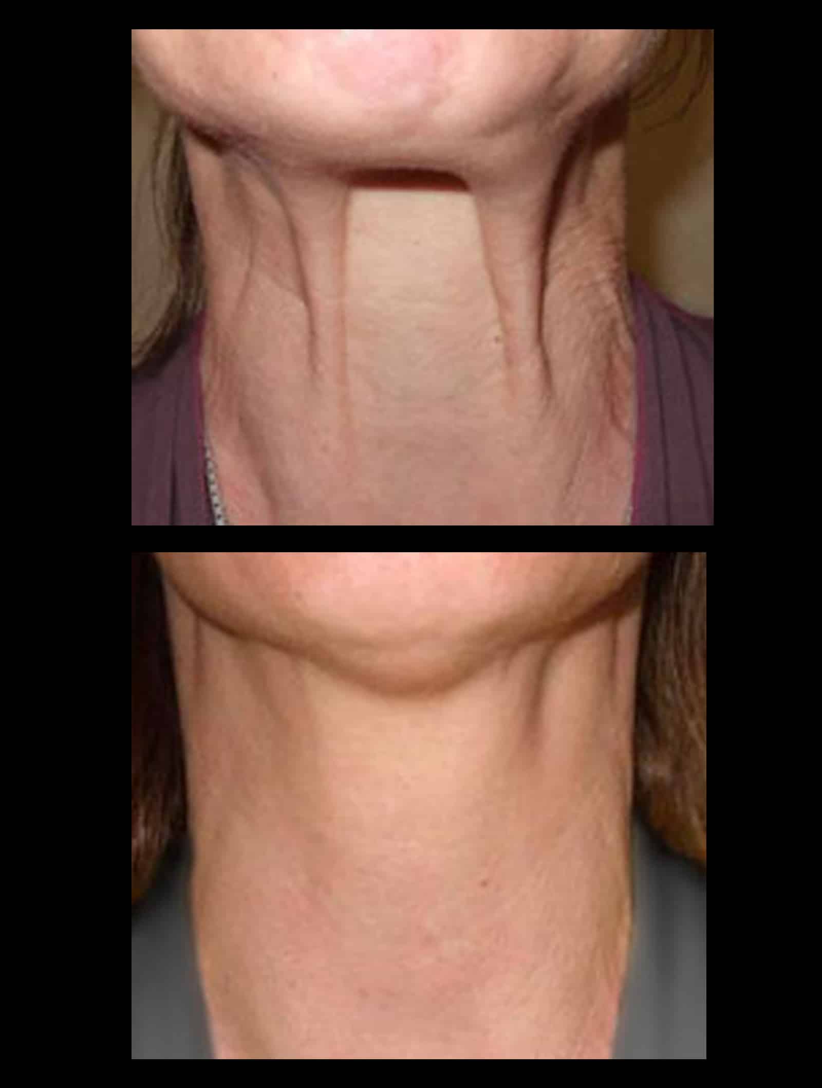 Results Timeline Results Timeline