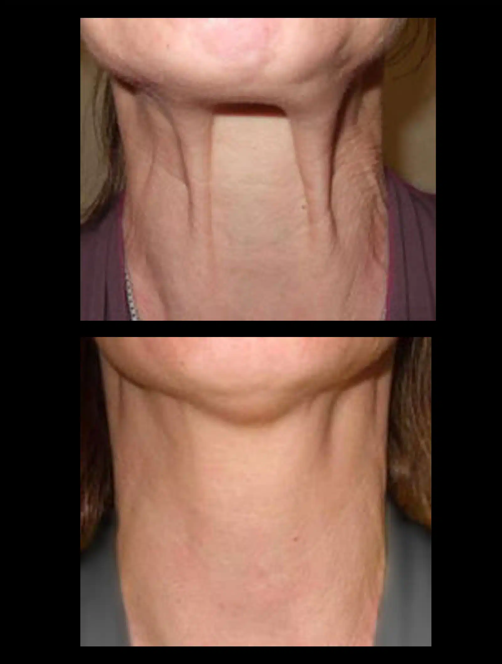 Results Timeline Results Timeline