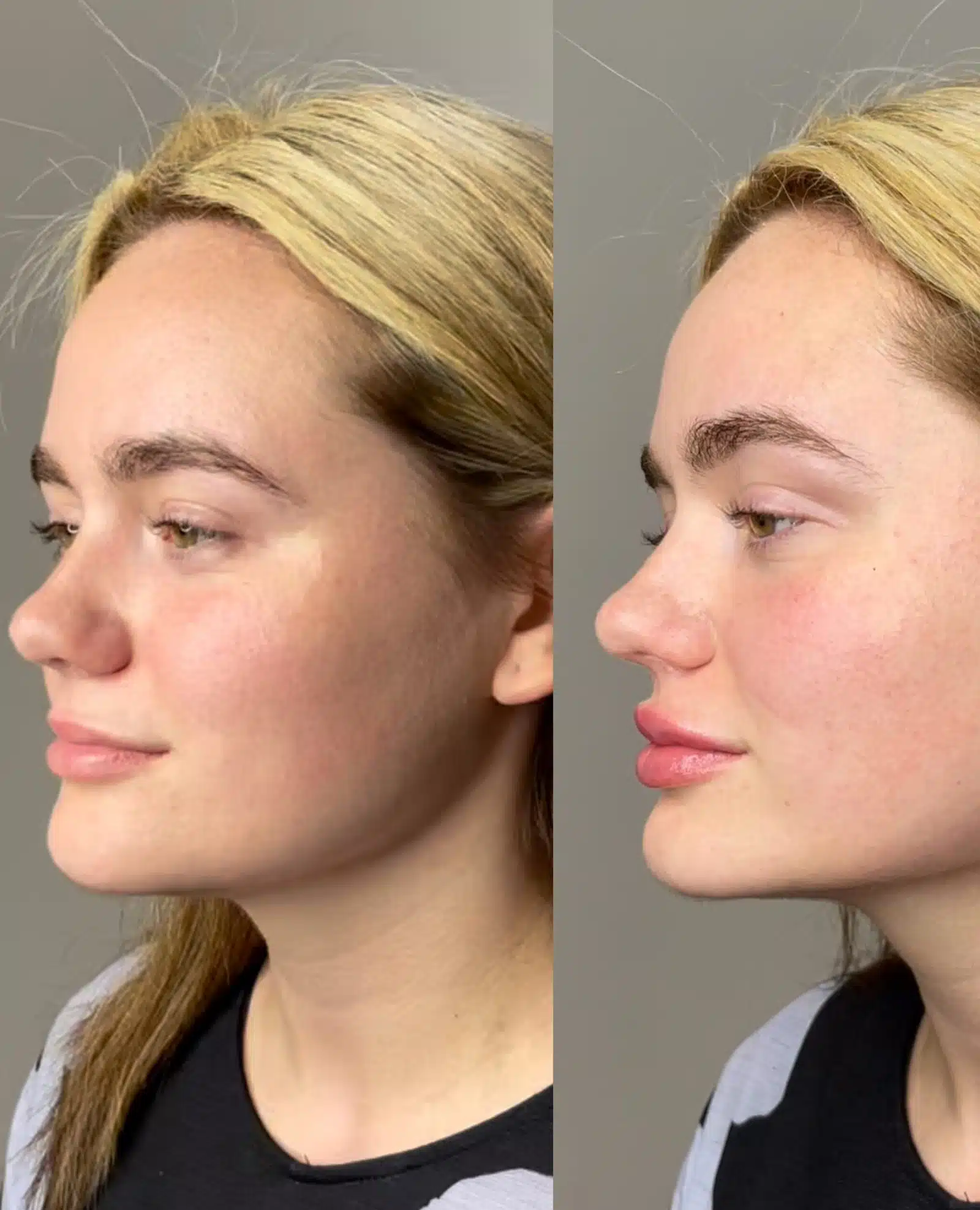 Sculpted, Youthful Profile