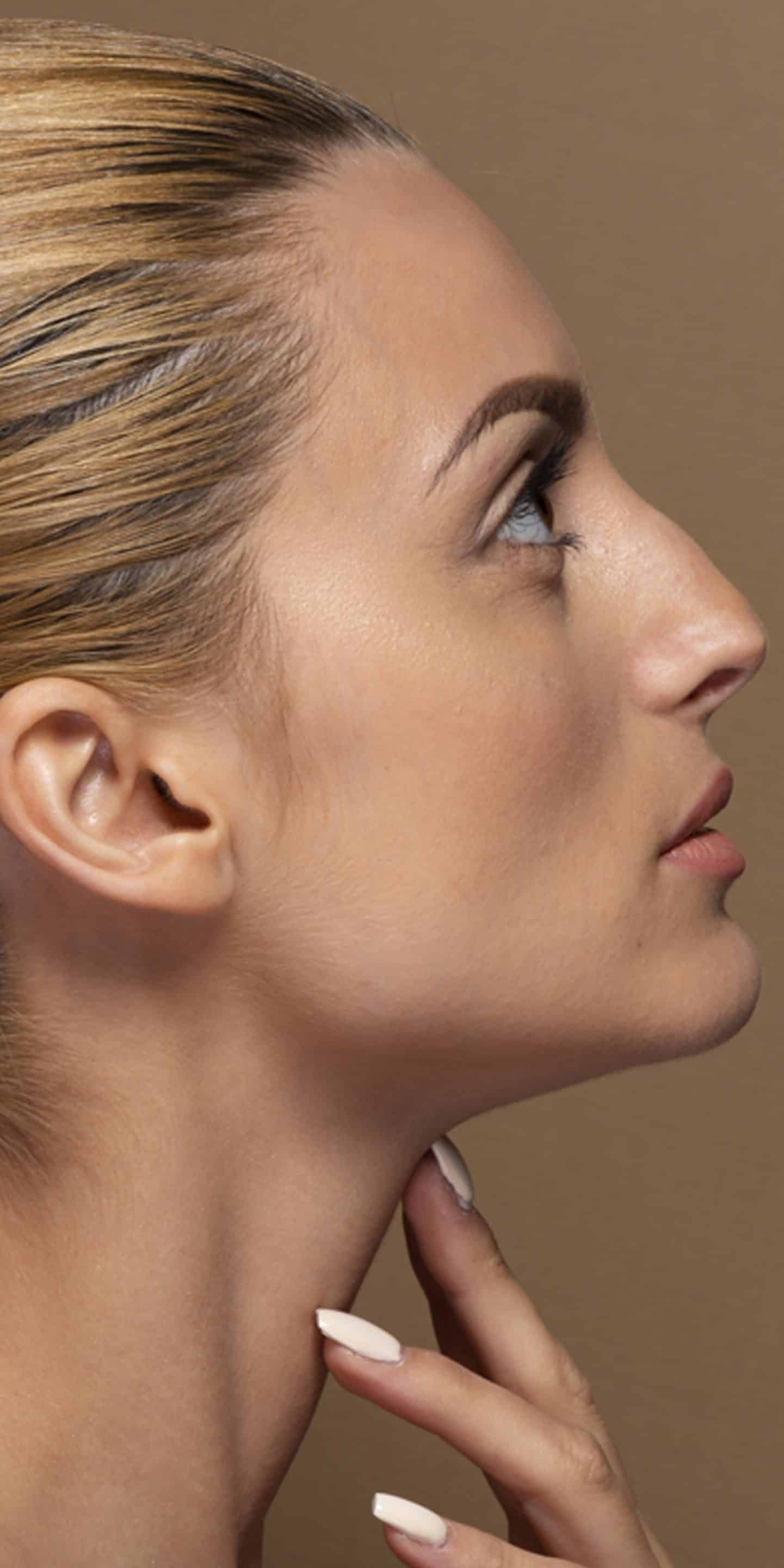 Strategic Filler Placement