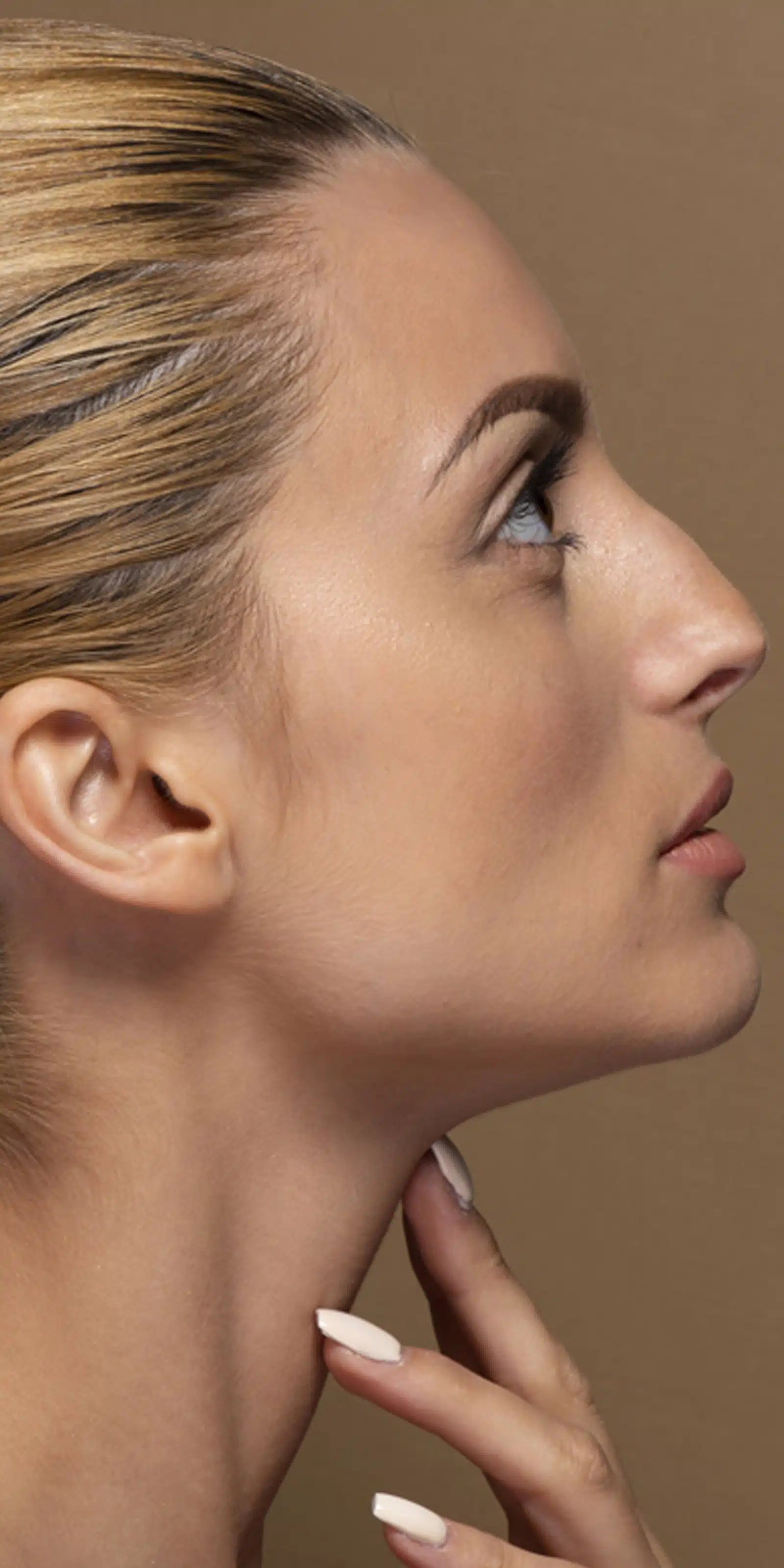 Strategic Filler Placement Strategic Filler Placement