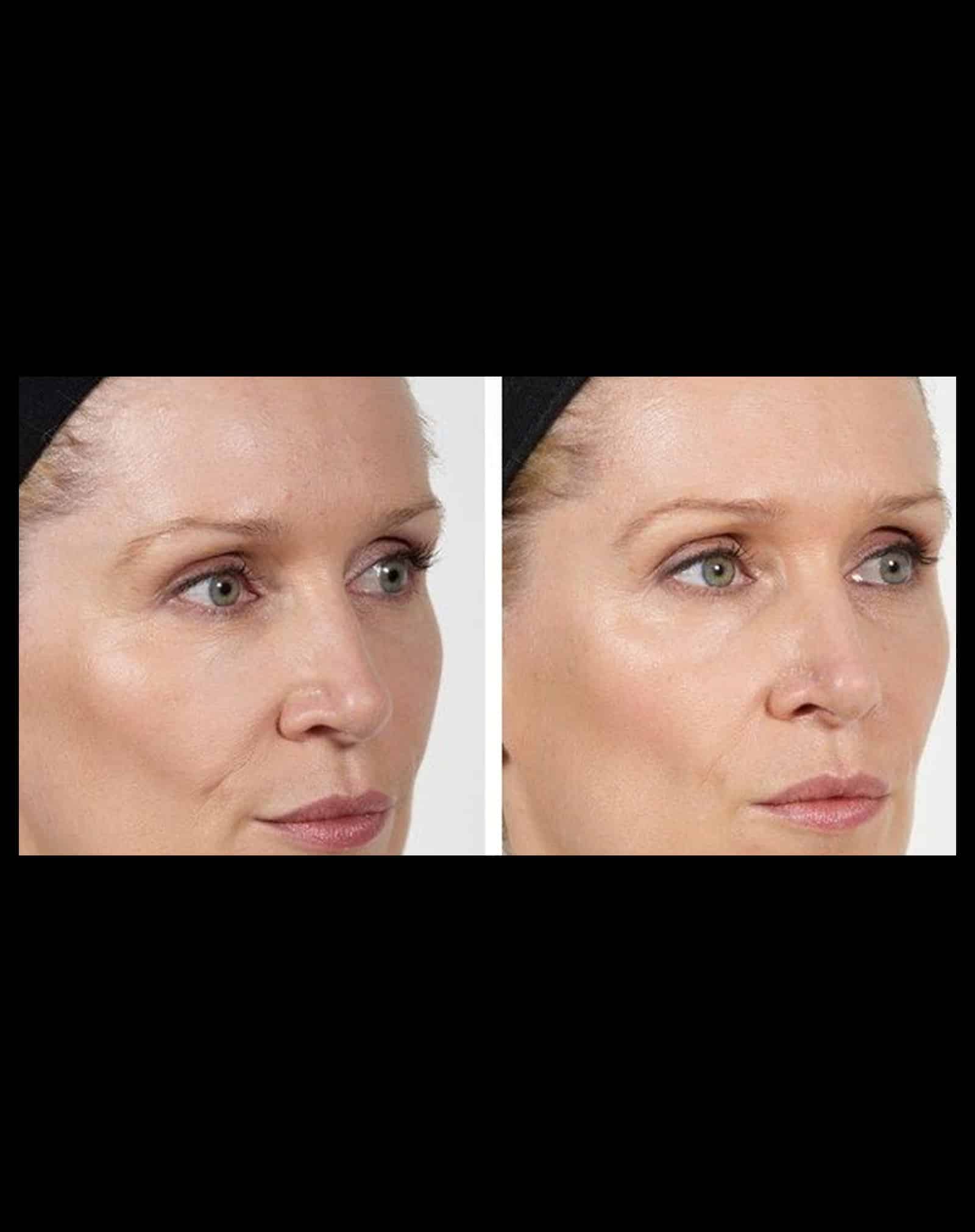 Treatment Preparation and Comfort