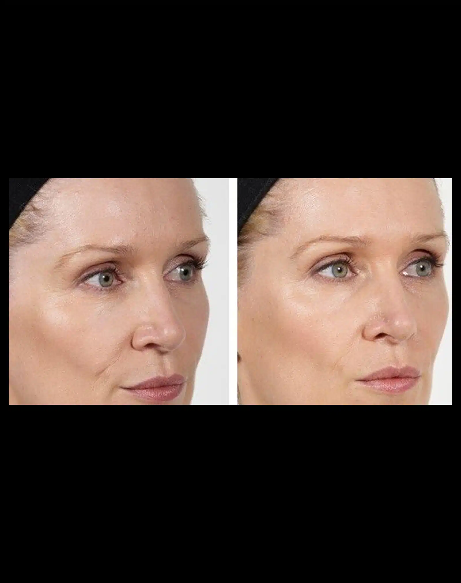 Treatment Preparation and Comfort Treatment Preparation and Comfort