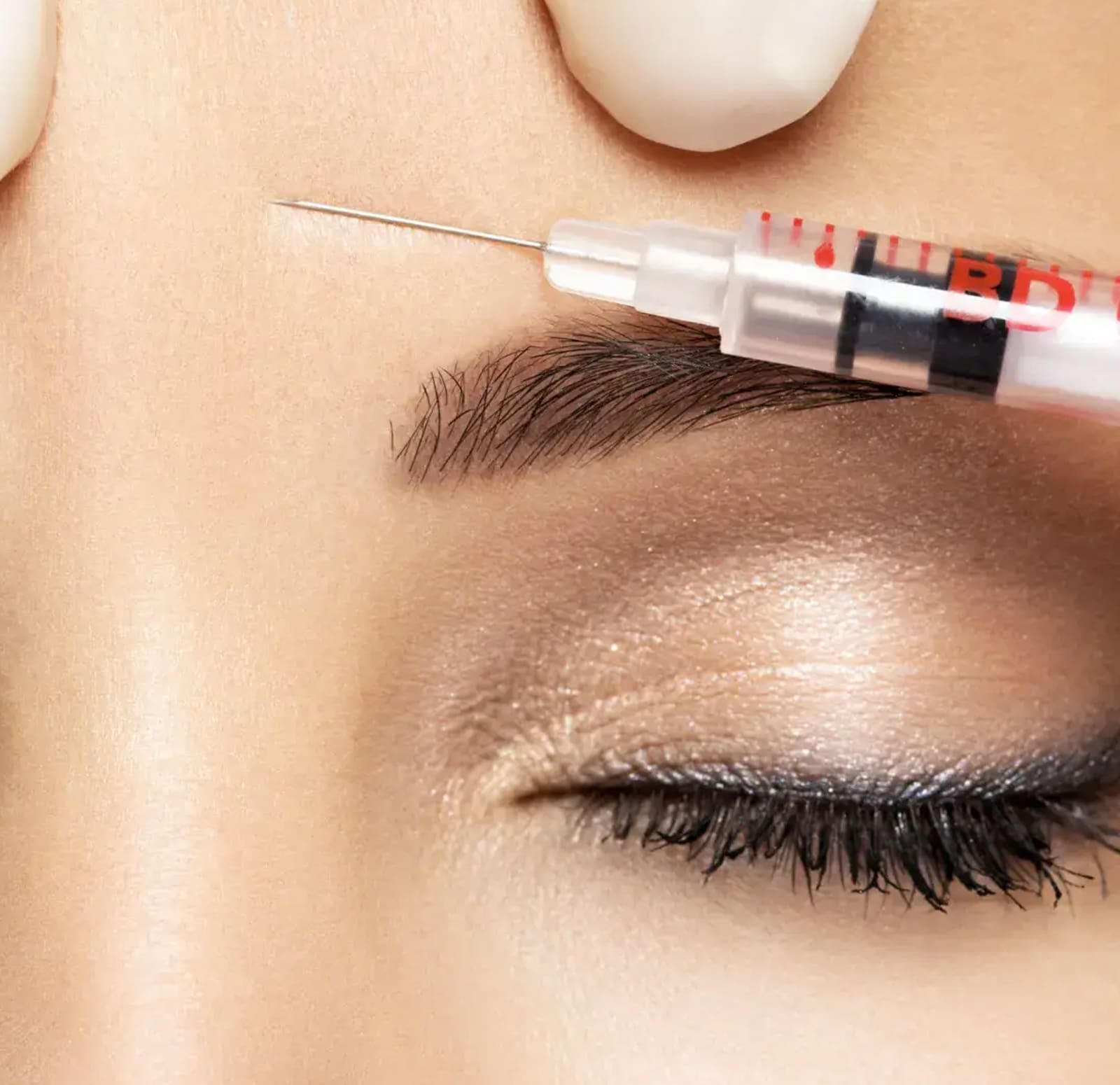 Understanding Forehead Lines