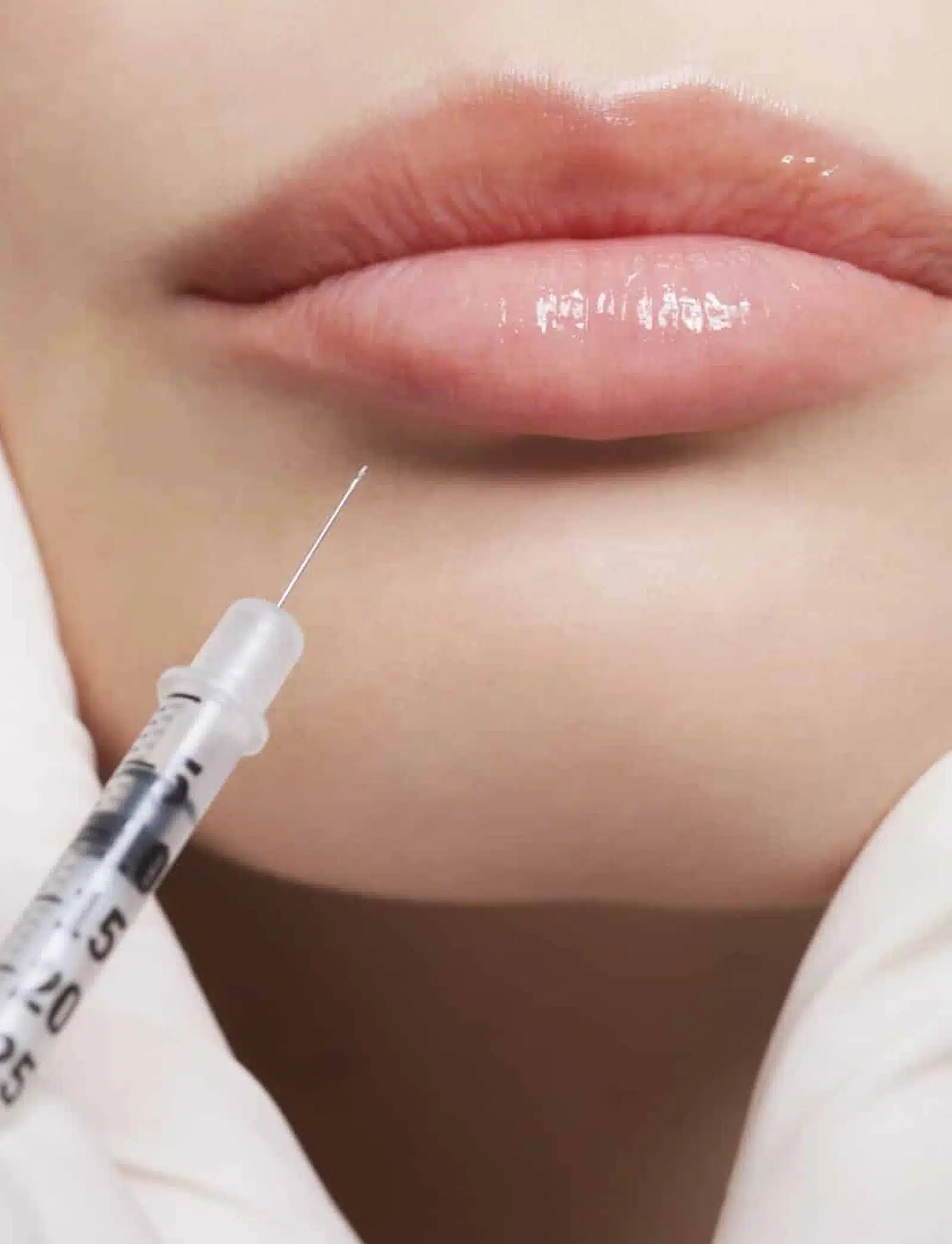 Youthful Volume Restoration