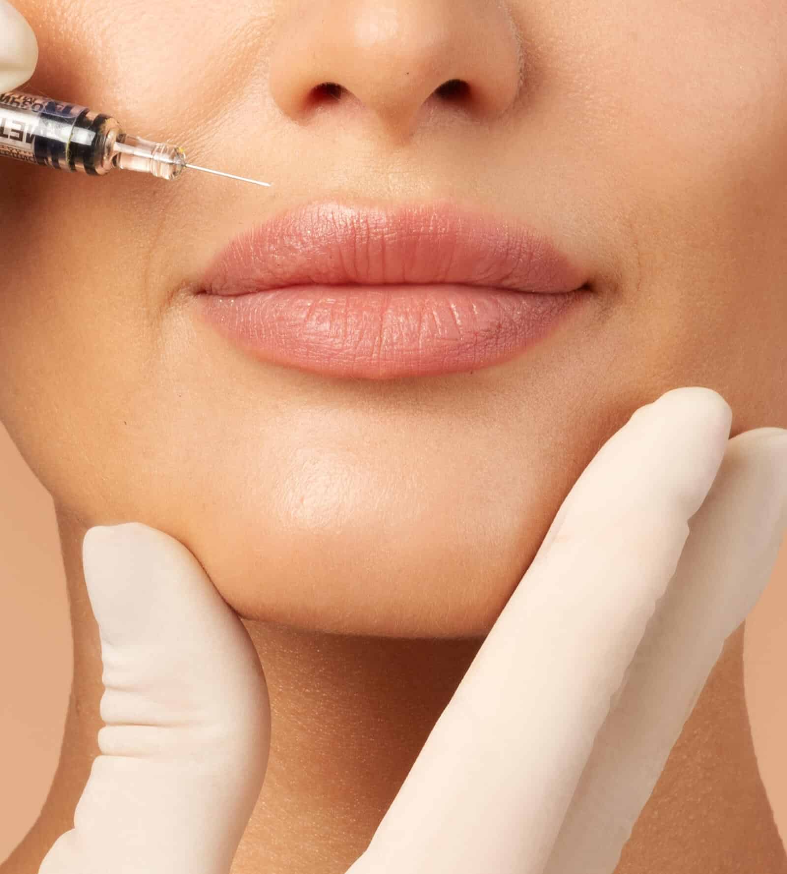lip augmentation lip augmentation